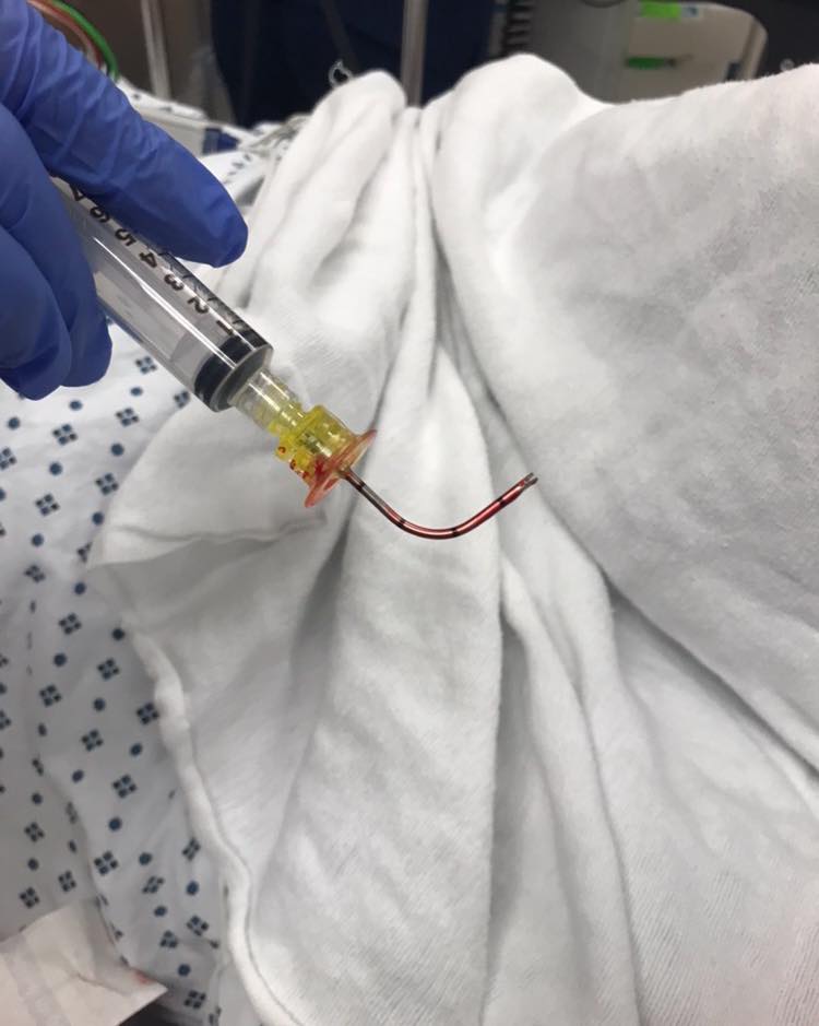 This is why you secure the arm of your patient that has an IO inserted into their humerus head for access. They will back out, but this one was unique…
#tactical #save #human #trauma #training #teaching #learning #community #medical #bethechange #life #vaemstg #emt #firefighter #fire #paramedic #ems #reels #school #education #virginia #group #youtube #knowledge #instagram #trending #facebook
