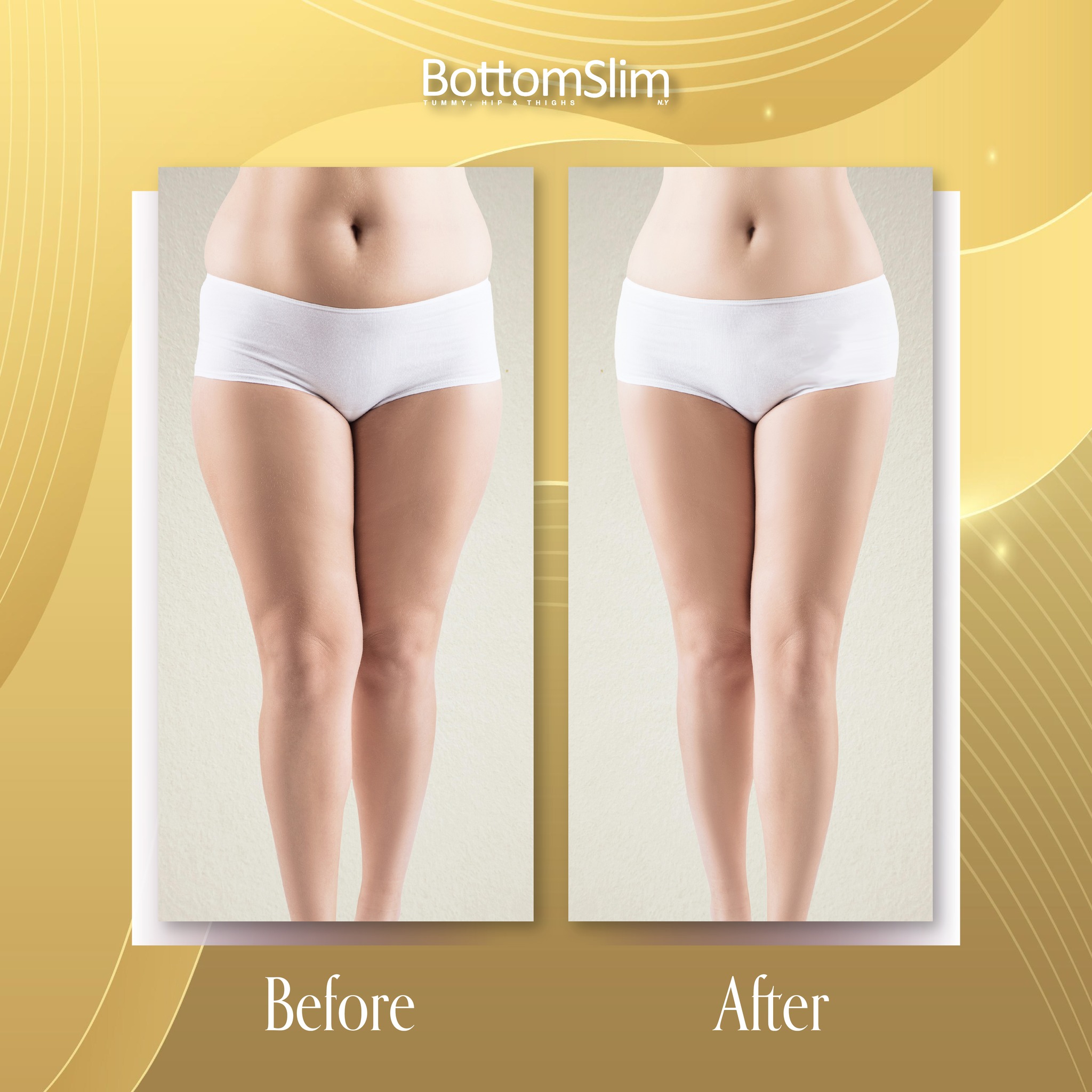 From shrinking silhouettes to soaring confidence!
This isn't just about a size down, it's about a whole new level of energy and a confidence that radiates from within. Talk about a total transformation! ✨
With BottomSlim, you can definitely embrace your best self and achieve your bottom slimming goals.
#BottomSlim #slimming #slim #beauty #treatment #bodytoning #bodyconfidence #Bodygoals #body #bodyshape #cellulite #unevenskin #exercise #slimcontour