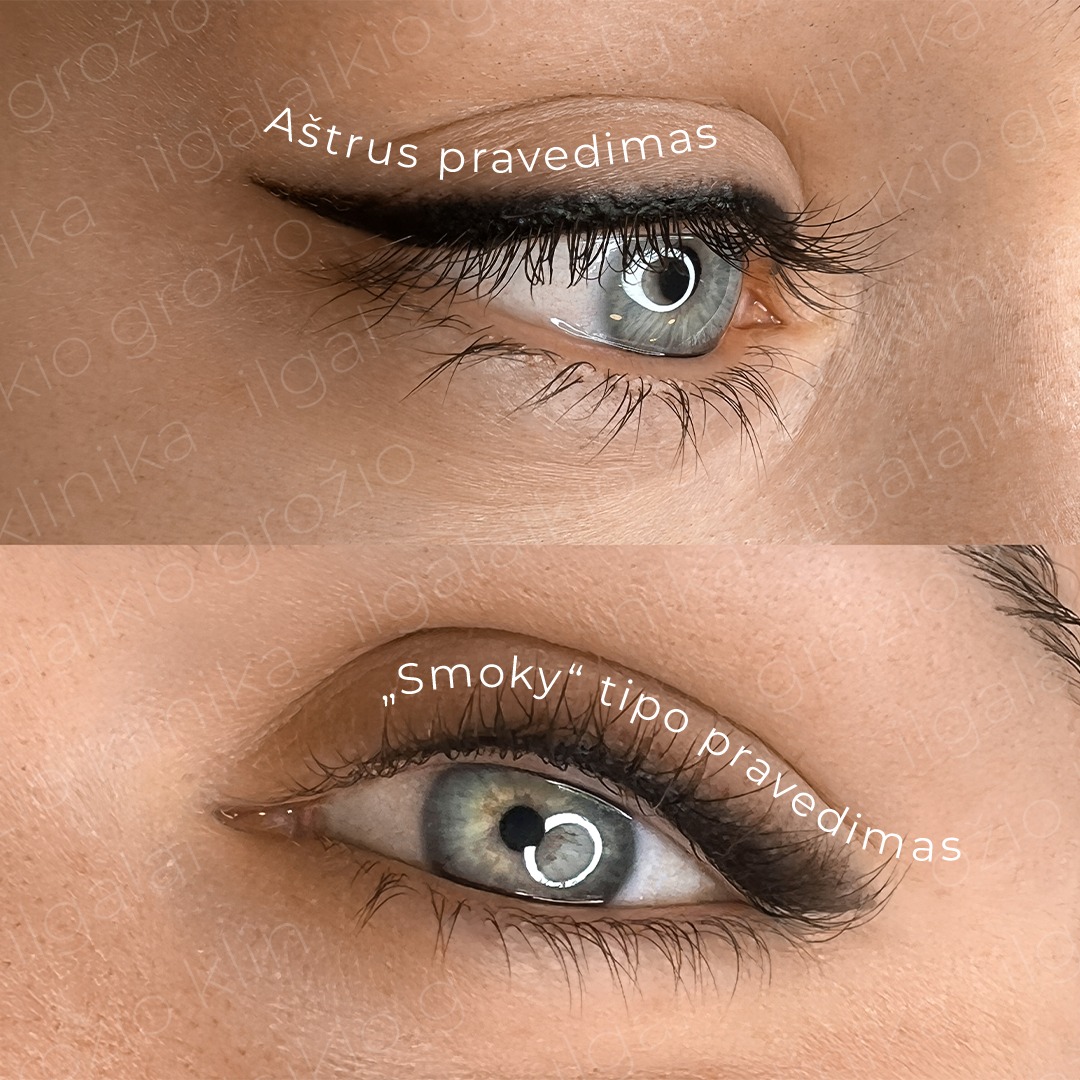 Užburiančiam žvilgsniui – kerintis permanentinio makiažo akių pravedimas 🐈⬛ Preciziškai tikslūs ir subtilūs meistrės Jovitos darbai kalba patys už save!
Kurią liniją pasirinktumėte Jūs: gundančiai aštrią ar viliojančią „smoky“ tipo?
Pasinaudokite 50 € nuolaida – registruokitės akių vokų permanentiniui makiažui:
📞 Telefonu: +370 670 14491
➡ Internetu: @ilgalaikio_grozio_klinika Treatwell programėlėje
💬 Asmenine žinute
🗺 Kaune, Savanorių pr. 139
#Kaunas #makiazas #permanentinismakiazas #akys #akiupravedimas #ilgalaikismakiazas #groziosalonas #makiazaskaune #permanentmakeuplithuania