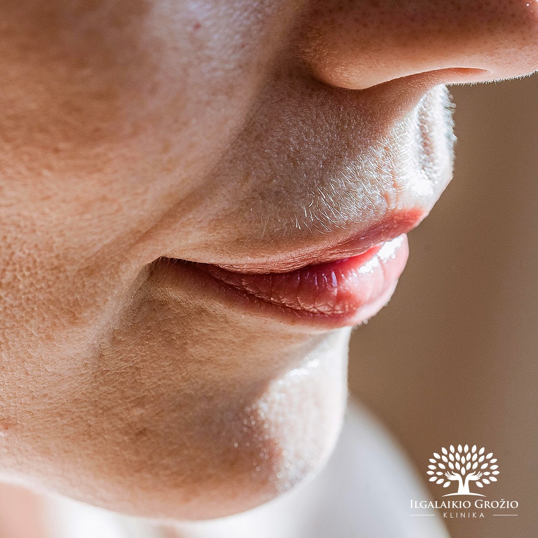 Vasara baigiasi, o nuolaidos – ne! 💸 Pasinaudokite ypatingu pasiūlymu plaukelių šalinimui lazeriu ir mėgaukitės komfortu: jokio odos sudirgimo po skutimo ar įaugusių plaukelių.
🎁 Dovana užsakant bet kurią zoną ar jų rinkinį: plaukelių šalinimas aplink spenelius arba pilvo juostą vos už 1 €.
Registruokitės jau dabar:
📞 Telefonu: +370 670 14491
➡ Internetu: @ilgalaikio_grozio_klinika Treatwell programėlėje
💬 Asmenine žinute
🗺 Kaune, Savanorių pr. 139
#Kaunas #plaukeliusalinimas #plaukeliusalinimaslazeriu #depiliacija #plaukeliusalinimaslazeriukaune #sapphireLS1200 #plaukeliusalinimasbeskausmo #depiliacijakaune