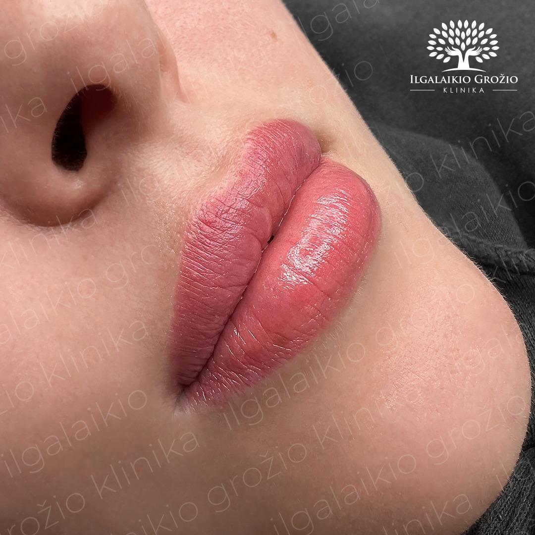 Žavinga – kiekvieną dieną 💋 Permanentinis lūpų makiažas suteikia spalvą ir kontūrą, o meistrės Jovitos profesionalus prisilietimas sukuria natūralų efektą.
Kodėl verta rinktis permanentinį lūpų makiažą?
🔸 Ilgalaikė, subtili spalva;
🔸 Tobula forma, pritaikyta Jūsų veidui;
🔸 Nepriekaištinga išvaizda 24/7.
Investuokite į ilgalaikį grožį jau šiandien – registruokitės ir mėgaukitės rezultatu:
📞 Telefonu: +370 670 14491
➡ Internetu: @ilgalaikio_grozio_klinika Treatwell programėlėje
💬 Asmenine žinute
🗺 Kaune, Savanorių pr. 139
#Kaunas #makiazas #permanentinismakiazas #ilgalaikismakiazas #groziosalonas #makiazaskaune #permanentmakeuplithuania