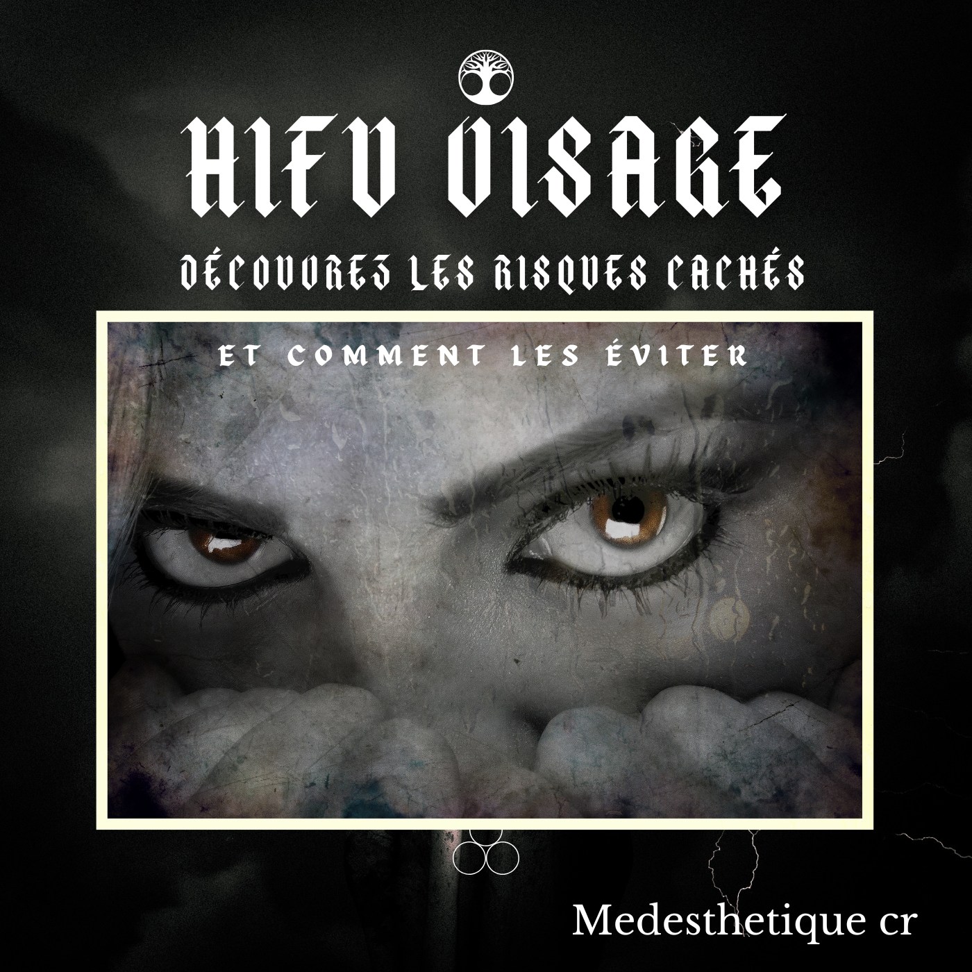 🌟 Lifting HIFU : Peut-il vraiment tourner mal ? Voici ce que vous devez savoir !🌟
Si vous une solution non invasive pour lutter contre le relâchement cutané et redonner de la fermeté à votre peau, le HIFU (High-Intensity Focused Ultrasound) pourrait être la solution idéale. Mais avant de vous lancer, il est crucial de bien comprendre cette procédure et ses risques potentiels. Le HIFU est-il vraiment sans danger ? Quels sont les effets secondaires à connaître ? Peut-il mal se dérouler et provoquer des complications ?
👉 Lire l'article maintenant https://www.medesthetiquecr.com/post/hifu-traitement-du-relachement-cutane-par-les-ultrasons-le-lifting-hifu-peut-il-tourner-au-cauchemar