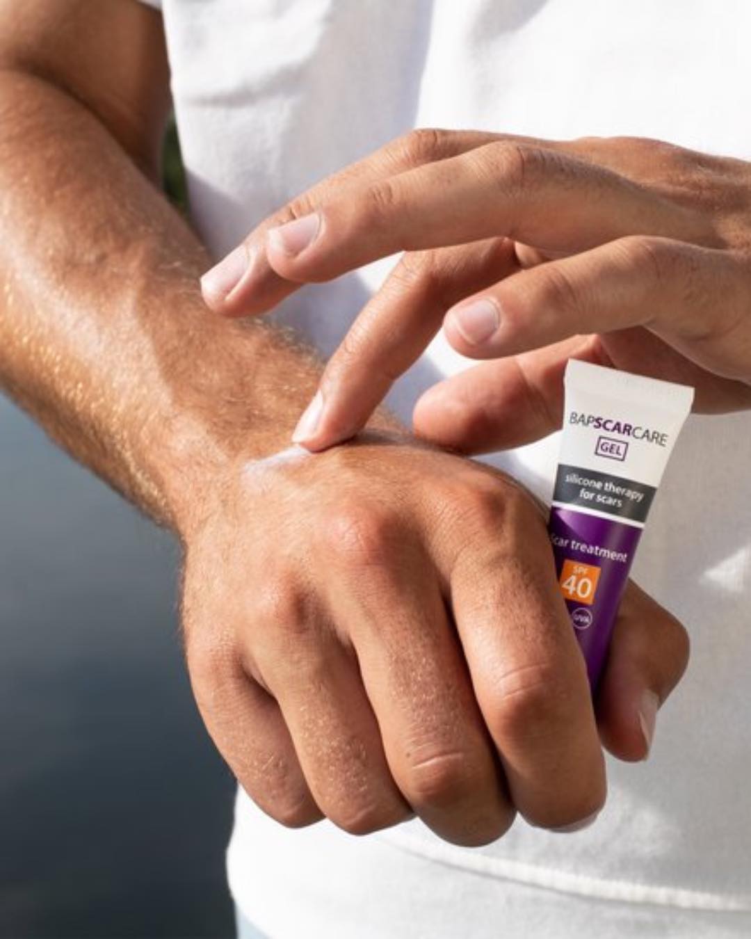 Er du plaget med synlige arr etter akne, skade eller operasjon? 🤕
Gi huden din profesjonell behandling med BapScarCare – medisinsk silikonterapi utviklet for å redusere og forebygge arr! Nå tilgjengelig i vår salong 🛍
BapScarCare Silicone Gel med eller uten UV-beskyttelse er svært effektive for å redusere rødhet, kløe og tykkelse i arr. Gelen legger seg som en usynlig, pustende film over huden og er ideell til daglig bruk – også under sminke.
Velg den som passer deg best:
🧴Silicone Gel – perfekt for arr på kropp og ansikt
🧴Silicone Gel med UV-beskyttelse – ideell for arr utsatt for sol, som ansikt, hals og hender
Hvorfor velge BapScarCare?
✅ Klinisk dokumentert effekt – anbefalt av spesialister
✅ Forebygger dannelsen av harde og synlige arr
✅ Komfortabel i bruk – klistrer ikke og tørker raskt
✅ Kan brukes på nye og gamle arr
✅ Reduserer kløe, rødhet og tykkelse i arr
Ta vare på huden din – fordi hvert arr fortjener omsorg ❤️🩹
Svipe for før og etter bilder 👉
#Arrbehandling #Silikongel #BAPSCARCARE #Sårbehandling
#TemaHud #formerennvelvære #Asker #Nesbru #Holmen #holmensenter #hudpleie #hudpleieasker #hudpleienesbru #hudpleieholmen #hudpleietips #hudpleieprodukter #hudpleierutine #hudpleiesalong #handlelokalt #støttsmåbedrifter