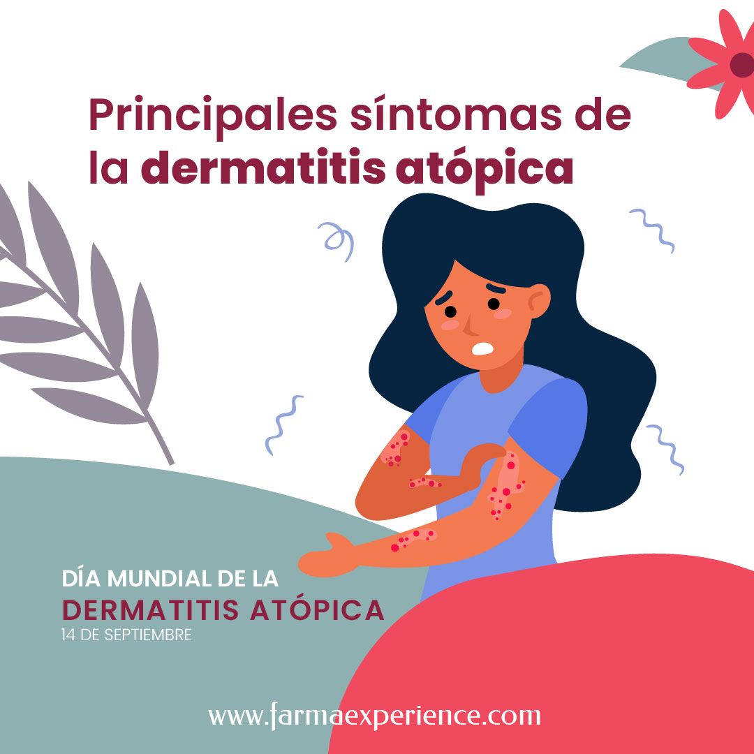 La dermatitis atópica o eccema atópico es una enfermedad inflamatoria crónica de la piel, caracterizada por una picazón intensa en cualquier parte del cuerpo, asociada con lesiones cutáneas y heridas.
Puede tornarse de moderada a severa, caracterizada por brotes intensos que puede comprometer el estado de salud del paciente, con patologías asociadas como asma, alergias, conjuntivitis alérgica, pólipos nasales y rinosinusitis.
👍🏻 Consúltanos podemos asesorarte.
#farmacia #madrid #PielAtopica #diamundial #FarmaExperience #cuidadeti #cuidatupiel #productospielatopica
#díamundialdermatitisatópica