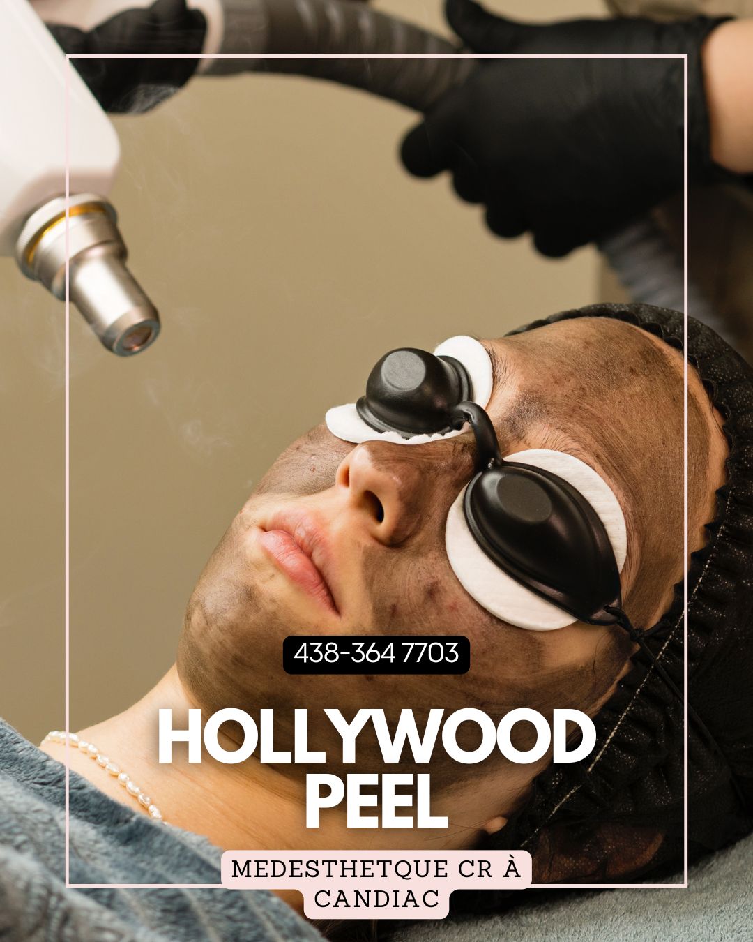🌟 HOLLYWOOD PEEL – 20 % DE RABAIS POUR VOTRE PREMIER TRAITEMENT 🌟
✨ Le soin le plus éclatant pour une peau visiblement plus lumineuse dès la première séance !
Envie d’un teint lisse, uniforme et sans imperfections ?
Le Hollywood Peel, aussi appelé Carbon Peel, est le soin préféré des stars pour un coup d’éclat immédiat sans éviction sociale. Il aide à resserrer les pores, à atténuer les taches pigmentaires, les imperfections et les signes de fatigue, tout en redonnant de la fraîcheur à votre teint.
🔥 Offre découverte : -20 % sur votre première séance !
📅 Offre valable jusqu’au 30 avril 2025.
📍 Medesthétique CR – Candiac (Rive-Sud de Montréal)
💬 Consultation gratuite et sans engagement.
📲 Réservez votre place maintenant par message ou au 438-364-7703.
✨ Les places sont limitées !