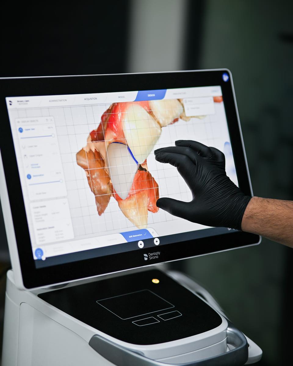 Transforming smiles with precision! ✨
Our intraoral scanner captures the
complete 3D shape of your teeth and
gums using advanced light and laser
technology. Experience the future of
dentistry with digital impressions that are
comfortable, accurate, and viewed in
real-time. Your perfect smile starts here!
🦷
#drtooth #dentist #dentalcare
#dentalhealth #smilemakeover
#oralhealth #familydentistry
#digitaldentistry #dentaltechnology
#dentalservices #dentistry #smile