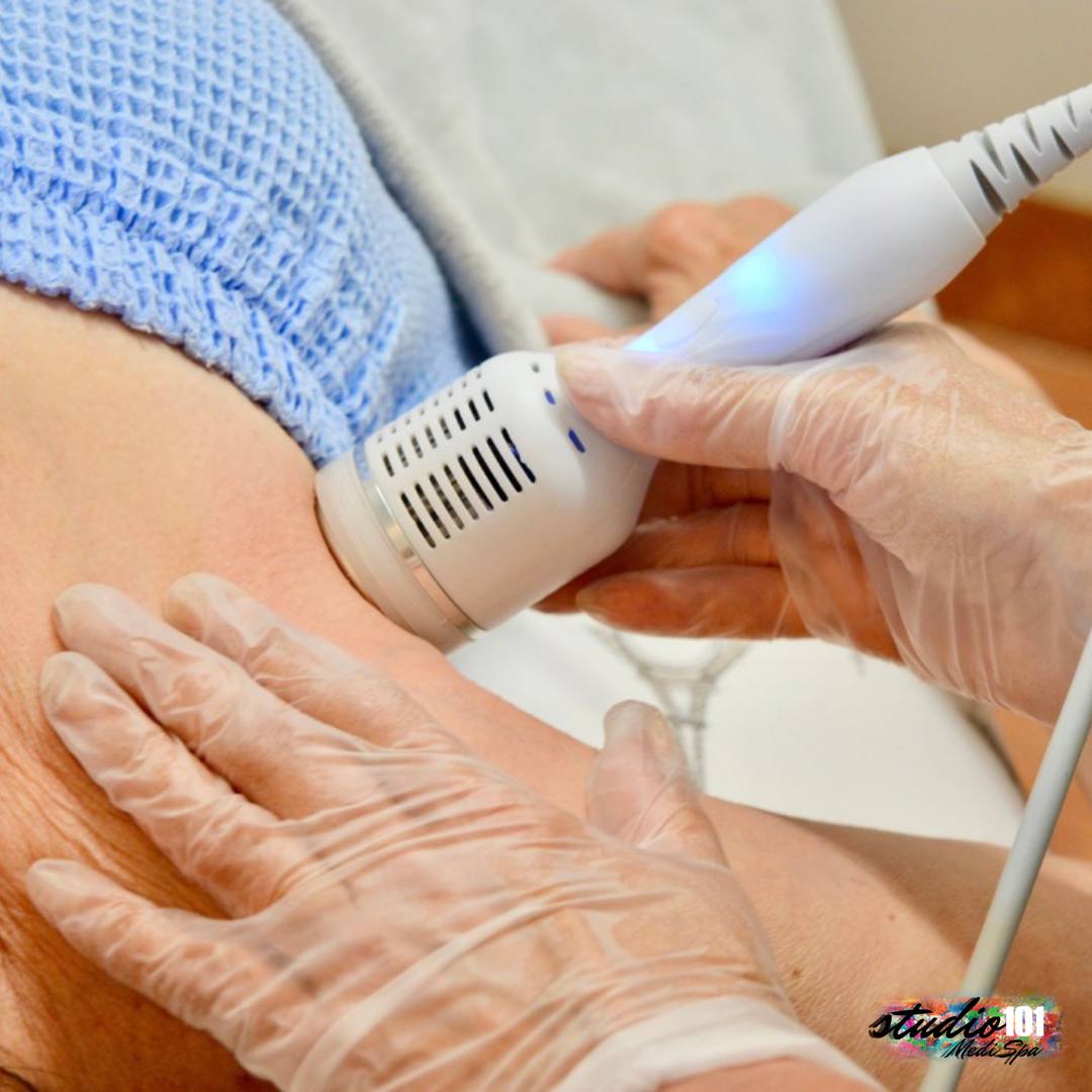 Radiofrequency (RF) treatments can work wonders! RF uses controlled heat to stimulate collagen production, tighten skin, and reduce fine lines and wrinkles. Plus, there is minimal downtown, making it a convenient option for those looking to rejuvenate their skin.
Contact us for a free consultation to ensure maximized results for your specific needs.
#studio101medispa #radiofrequency #rejuvenation