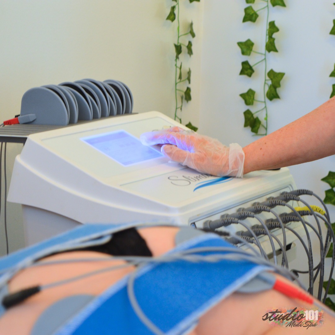 Slimwave's Electro Muscle Stimulation (EMS) machine offers nine programs to slim, tone, and firm specific body areas through passive exercise.
This advanced, non-invasive treatment uses medically approved stimulation to target fat at the cellular level, promoting inch loss, cellulite reduction, and improved circulation.
Each 45-minute session provides immediate results, making it a safe and effective alternative for body sculpting, weight loss, and muscle definition.
#Studio101medispa #slimwave #selfcare