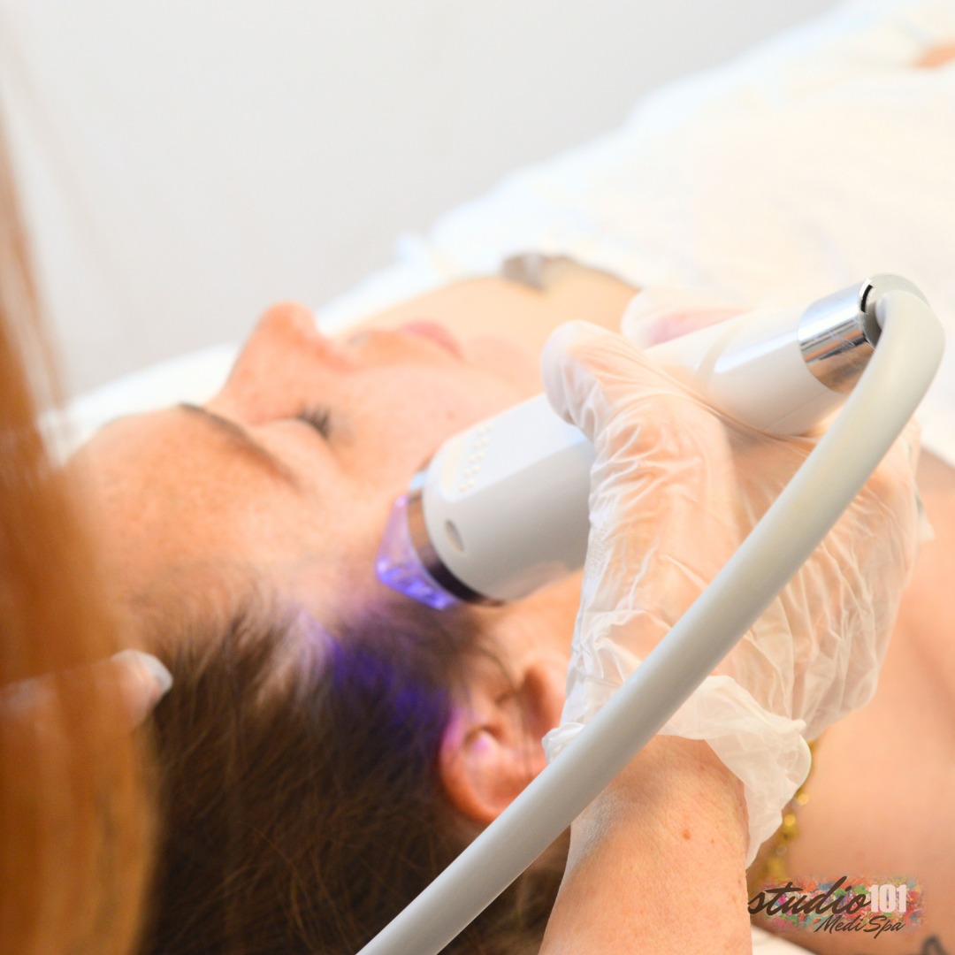 Fall weather can leave skin feeling dry, dull, and lacking life. 🍂🍂
Our micro needling treatment restores radiance by boosting collagen, improving texture, and enhancing hydration—perfect for keeping your glow all season long!
#studio101medispa #microneedling #skinrejuvenation