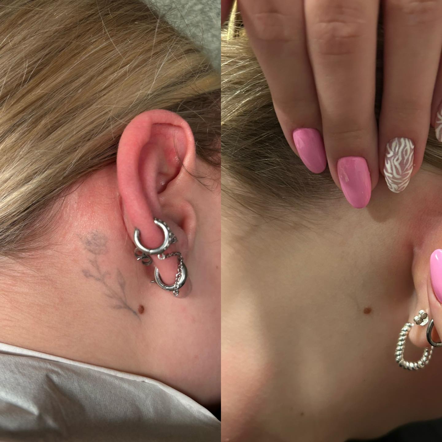 Tatoeages waar je spijt van hebt of graag vanaf wil…we horen het heel veel!
We hebben goed nieuws, dat kan nu!!
Op een veilige en effectieve manier d.m.v. behandeling met onze Picolaser.
Dit is het resultaat na slechts 1 behandeling!
Gemiddeld zijn er tussen de 3 en 10 behandelingen
nodig afhankelijk van de kleur, formaat, soort inkt en manier van zetten.
Vraag een gratis en vrijblijvend intake gesprek aan.
We hanteren deze zomer nog introductieprijzen vanaf €50,- per behandeling!
Wij adviseren graag!
#schoonheidssalonwilmameins #centrumveendam #langmairpicolaser #tattooremoval #liefzijnvoorjezelf