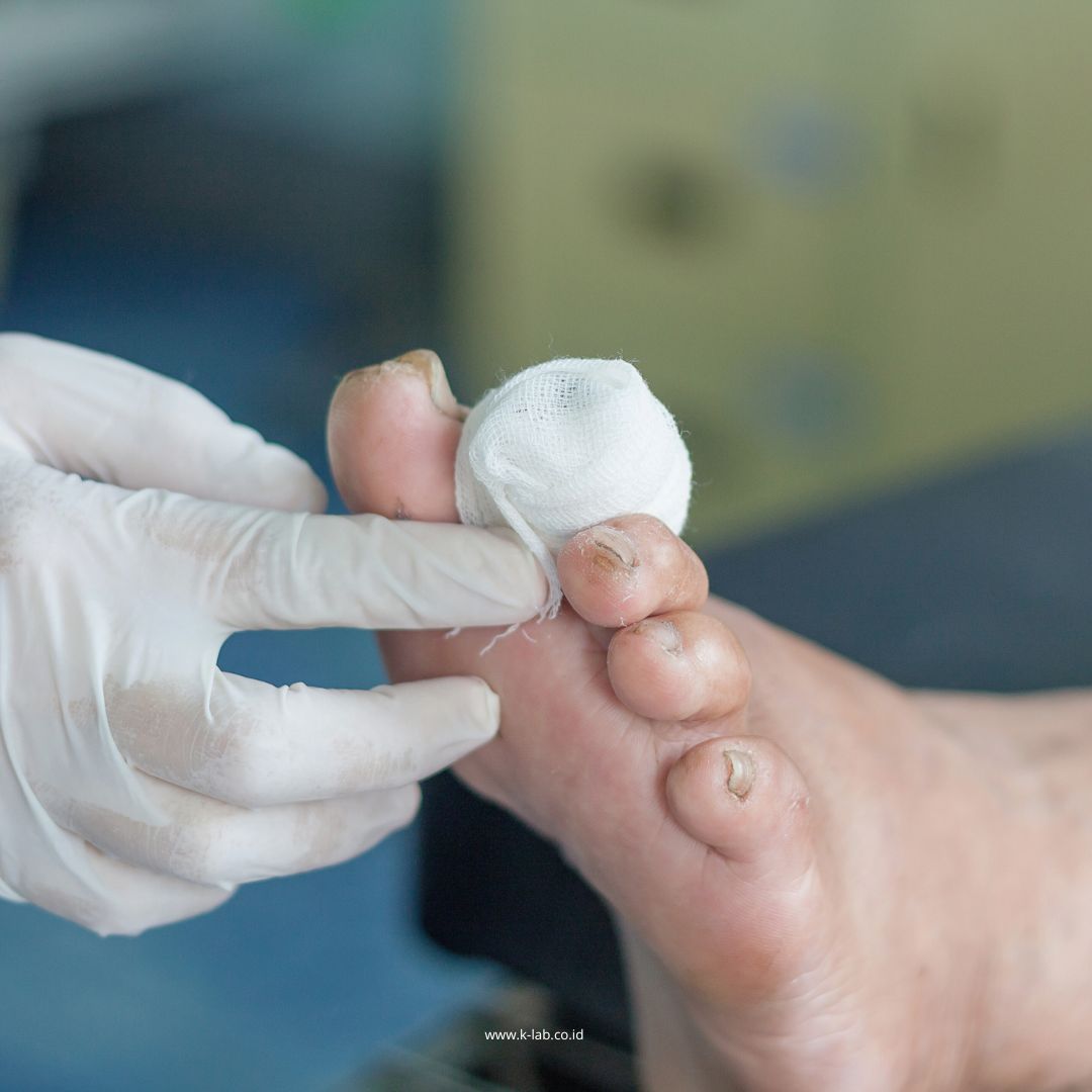 Suka makan dan minum manis, tapi belum pernah cek kondisi tubuh dari dalam? 🍩🥤
Yuk, jangan tunggu sampai terlambat! Cegah risiko diabetes sejak dini dengan tes kesehatan hanya Rp249.000! 🧬
📅 Promo berlaku sampai 21 Juli 2025
📲 Booking sekarang lewat WhatsApp: 081381367915
Ingat, menjaga kesehatan bukan soal menunggu sakit—tapi soal mencegah sebelum terlambat ❤️
#BeraniSehat #Promo #Klinik #Kesehatan