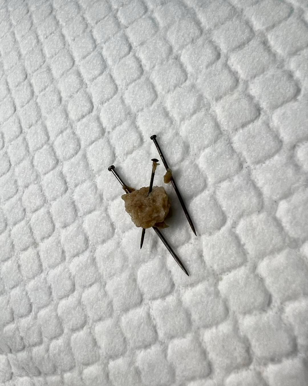 Tänään iltapäivällä saimme puhelun Sahalahden suunnalta, että koira on mahdollisesti päässyt lenkillä syömään neuloja sisältävän lihapullan.
Bablo lähtikin siis heti suorinta tietä saapumaan Tampereen klinikalle ja röntgenkuvat paljastivat ikävän totuuden - lihapullan sisällä oli tosiaankin ollut kolme neulaa.
Eläinlääkärimme Mari ja Jukka varasivat heti aikaa Bablon leikkaukselle ja myös klinikkaeläinhoitaja Maarit tarjoutui jäämään ylitöihin, jotta leikkaus saadaan tehtyä mahdollisimman pian. Kaikkien onneksi leikkaus sujui hyvin, neulat saatiin ulos ja Bablo pääsi vielä illalla takaisin kotiin toipumaan!
Tälläiset uutiset ihmisten kiusanteosta ovat niin kovin ikävää kuultavaa, lemmikit kun eivät koskaan ole syyllisiä siihen miksi joku tuntee niin kovasti vihaa sisällään. Olkaahan siis varovaisia ulkona, ettei kenenkään rakas lemmikki pääse pistämään suuhun mitään epämääräistä!
Pikaista paranemista suloinen seniori herra Bablo! ❤️