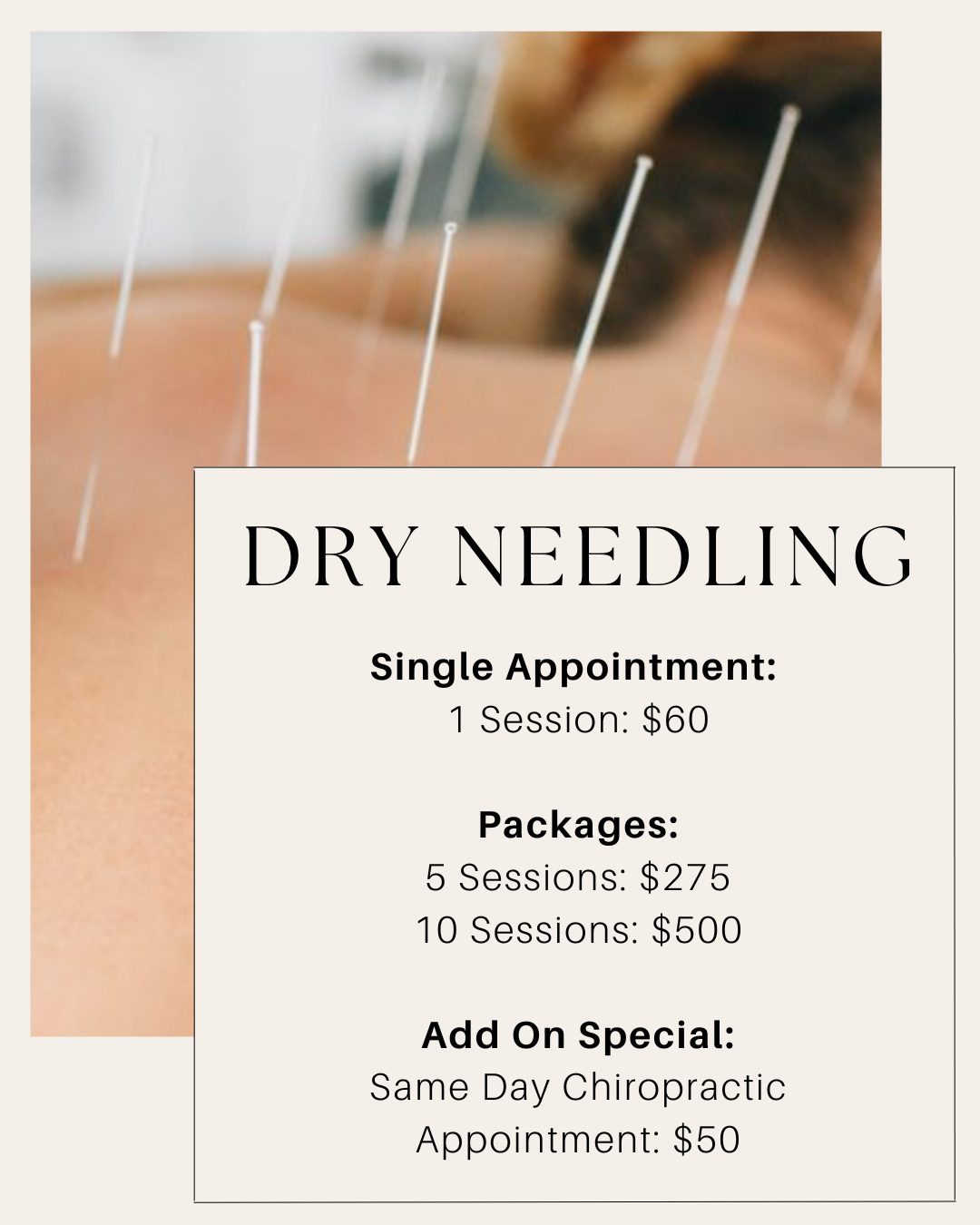 ✨ Dry Needling is Now Available at BodyWork Chiropractic & Wellness! ✨
We’re excited to offer dry needling as part of our services! This treatment is used to release tight muscles, reduce pain, and restore function. By targeting trigger points—those knots and areas of tension deep within the muscle—we can help improve mobility, enhance recovery, and support your overall wellness.
Whether you're dealing with chronic pain, recovering from an injury, or just feeling tight from everyday stress, dry needling may be the missing piece in your care plan.
📍 Pricing and package options are listed in the photo
📅 Ready to give it a try? Schedule online!