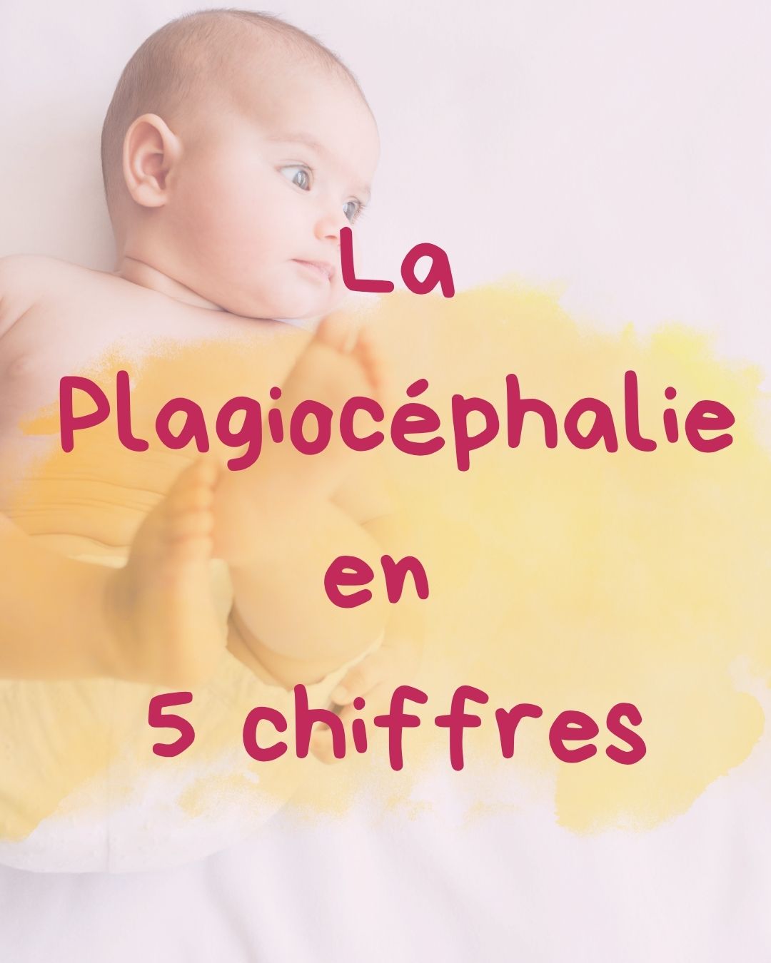 Un crâne qui s’aplatit, c’est souvent réversible… à condition d’agir tôt.
💡 Portage, tummy-time, séances kiné ciblées : on peut vraiment faire la différence !
👶 Fais vérifier la tête de ton bébé dès 6 semaines ! RDV en DM
#iledelareunion #posturebébé #ostéopathe974 #kinepediatrique #bebe974 #osteobebe #plagiocéphalie #teteplate #kinesitherapiepediatrique #brachycephalie #developpementduBébé #osteopathiepediatrique #motricitelibre #bebe2025 #bébé974🇷🇪 #bebe #developpementmoteur #kinesitherapie #preventionbebe
#plagiocephalie #preventionbebe #kine_marmay