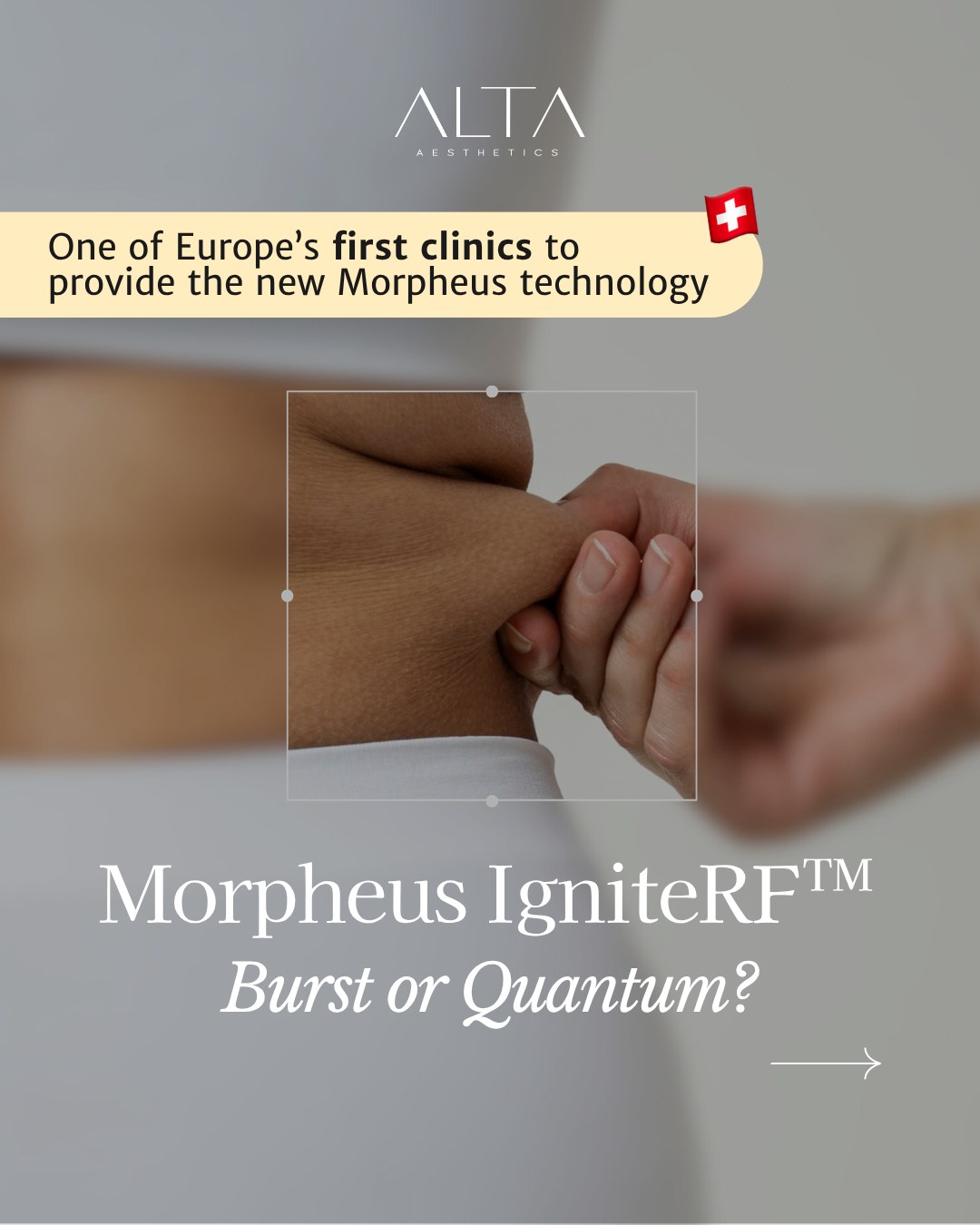 We are among the first clinics in Europe to offer the new Morpheus IgniteRF™ technology, and with it, both Burst and Quantum options to fully personalize your treatment. ✨
At ALTA Aesthetics, we combine these technologies to address different concerns:
🔬 Burst: perfect for reducing cellulite dimples and refining skin texture.
💎 Quantum: ideal for deeper tissue tightening and reshaping body contours.
Not sure which one is right for you?
That’s why every journey at ALTA starts with a first free* medical consultation and a personalized plan.
📍 Book your consultation today and discover which technology is best for your skin goals.
* The cost of the initial consultation (CHF 150) will be automatically deducted from your first Morpheus treatment.