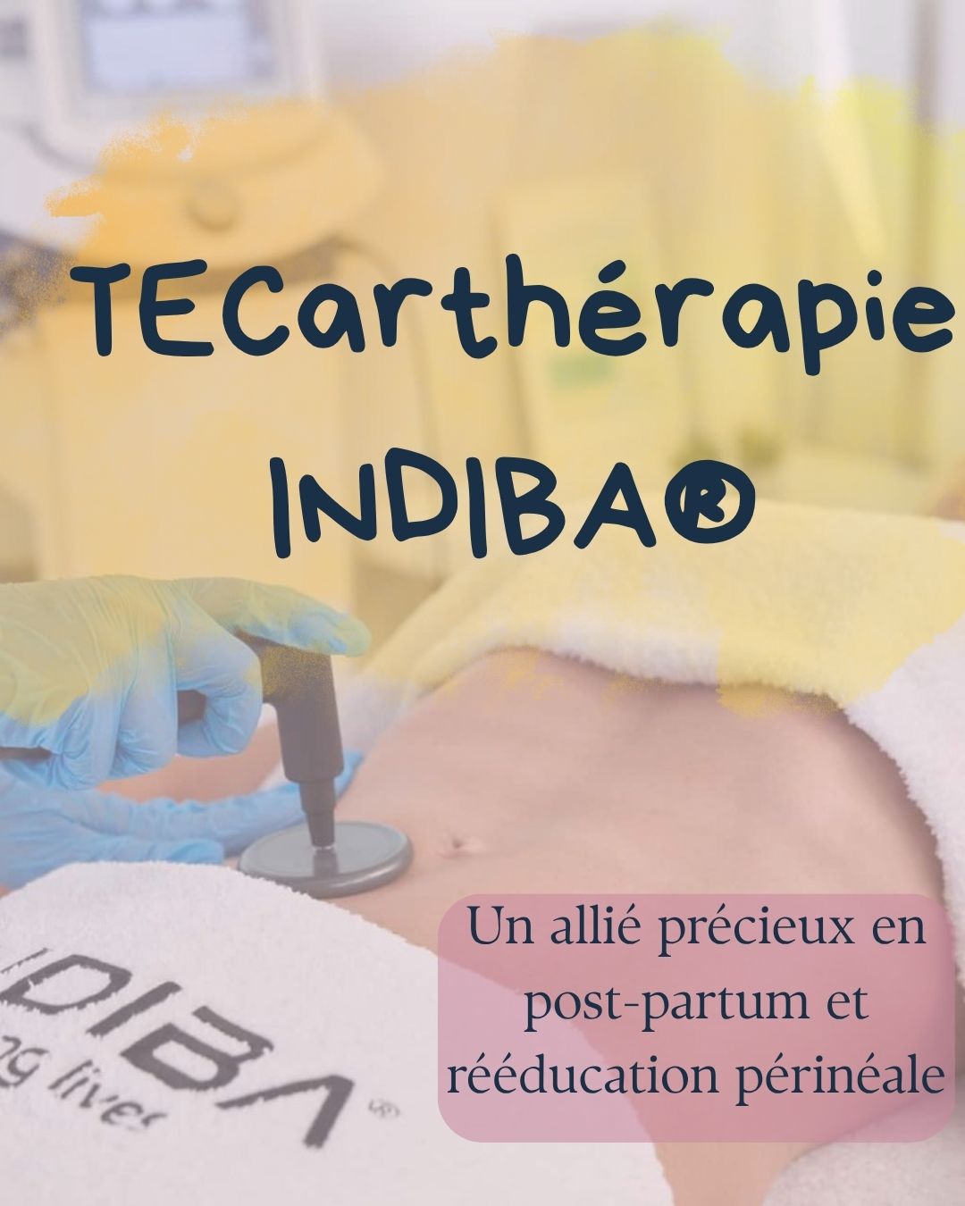 🩺 TECarthérapie INDIBA® : une alliée précieuse en post-partum et pour la santé pelvienne !
Tu viens d’accoucher ? Tu ressens des douleurs, une cicatrice qui tiraille, une sensation de pesanteur ou des fuites urinaires ? La TECarthérapie INDIBA® peut t’aider à mieux récupérer. ✨
➡️ Cette technologie douce stimule la régénération des tissus et réduit l’inflammation grâce à une radiofréquence de 448 kHz. Elle est parfaitement intégrée dans les séances de kiné en pelvi-périnéologie, et peut faire toute la différence dans ta récupération. 💪
💡 Chez Kiné Marmay, j’intègre INDIBA® dans les prises en charge post-partum ou pour les troubles pelviens selon les indications, toujours avec une approche globale, bienveillante et respectueuse de ton corps.
📩 Tu as des questions ? Tu veux savoir si c’est adapté pour toi ? Viens en discuter en message privé ou prends rendez-vous !
#indiba #indibatherapy #tecarthérapie #postpartumcare #perinee #kineperinee #kinesitherapiepelvienne #kinesitherapiedelafemme #postpartumrecovery #reeducationperineale #kinesitherapiepostnatale #kinesitherapiepelvipérinéale #kine_marmay #bébé974🇷🇪 #kineréunion #kiné974 #iledelareunion #saintpierre974
