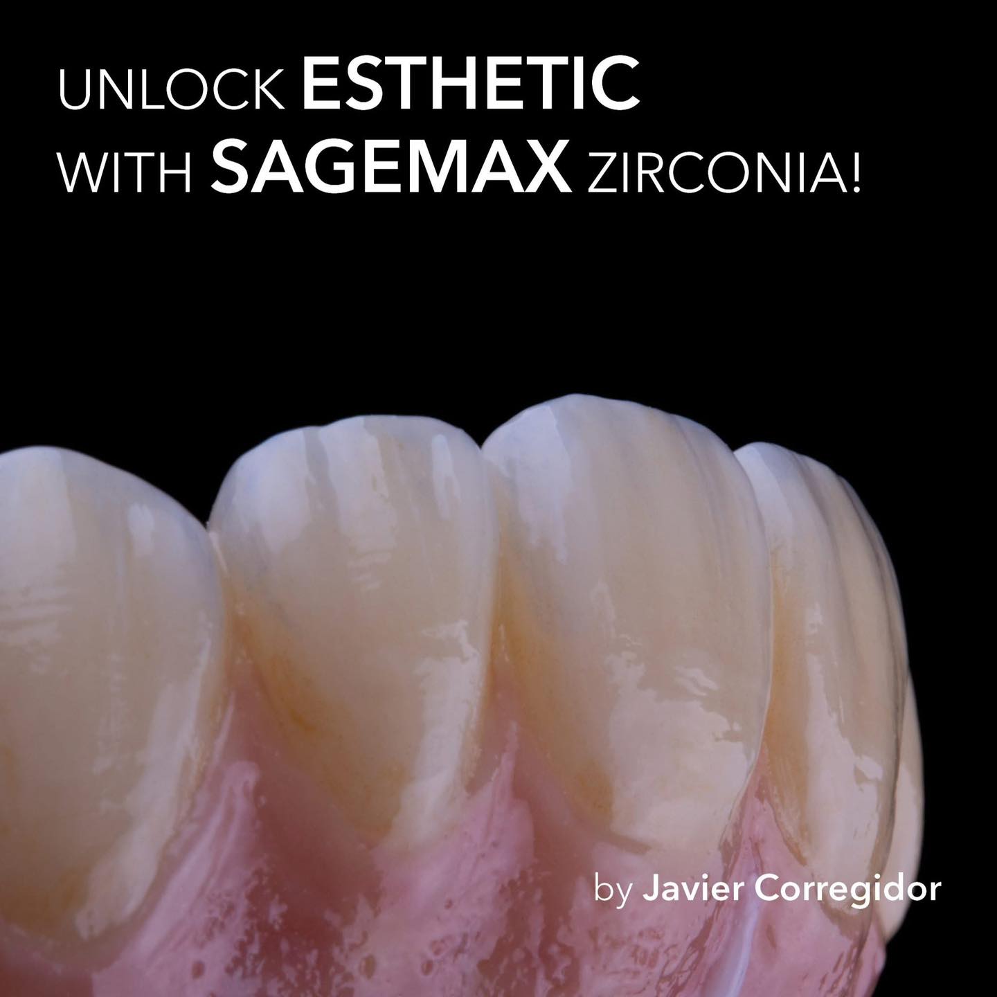 Sagemax Zirconia stands for: Premium quality.
Reliable strength. Exceptional esthetics. Thanks, Javier, for your beautiful craftsmanship!
. زيركونيا تعني : جودة ممتازة Sagemax
قوة فائقة يمكنك الاعتماد عليها و جمال استثنائي!
شكرا جافياى على حرفية عالية و عمل رائع.
@sagemax official
For more information on our products and for our latest promotions call us on
: 24513870 - 24513874
لمزيد من المعلومات و للاستعلام اتصل بنا : 24513870 - 24513874
#sagemax #dentalreels #dentalvideo #zirconiacrown #zahntechnik #odontologica #زركونيا_ديسك #جودة_تثق_بها #جودة_عالية #عيد_و_كبريته #عيد_و_كبريته