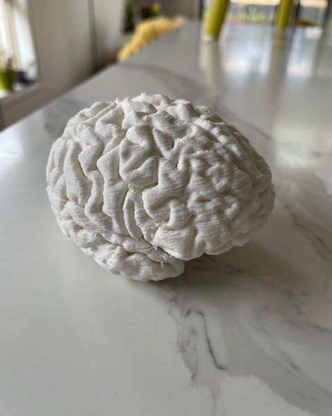 Today, July 22nd, is the 12th annual World Brain Day, designed to promote brain health across all stages of life. Brain health is essential for individual well-being and for societal progress.
One tip to protect the brain from the effects of chronic stress is to engage in activities that bring joy. Sleep, diet and exercise help keep your head above water. But experiencing joy releases feel-good neurochemicals that help reduce stress and contribute to overall brain health.
This picture is an actual 3-D model of my son‘s brain, who participated in a brain research study.