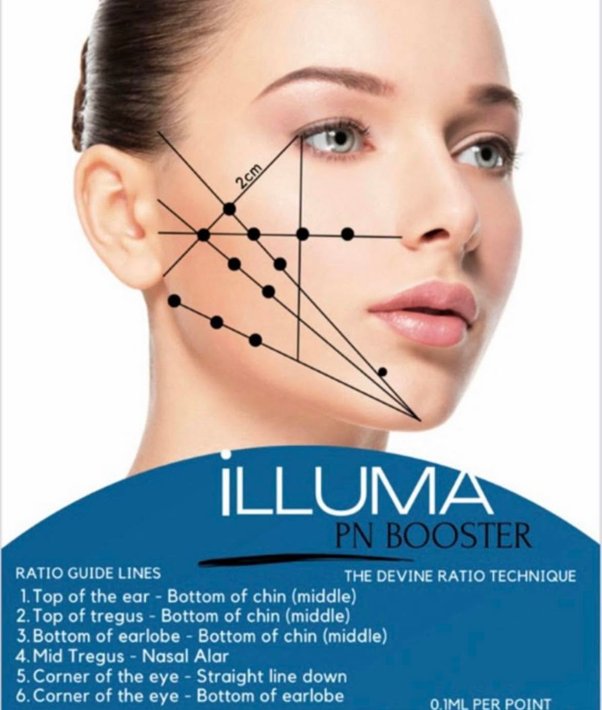 💉💉iLLUMA PN Booster 💉💉
The much talked about ‘salmon sperm DNA’ therapy
£159 per treatment
3 treatments recommended (one per month)
OFFER: All 3 treatments for £400
It is an innovative method of fighting all age-related skin changes.
Incredible blend of hyaluronic acid, polynucleotides and peptides ensuring comprehensive action in each treatment.
The booster contains 12 mg / ml stabilized Shiseido hyaluronic acid, which creates an intradermal filler effect (nourishes and moisturizes the skin)
The PN polynucleotides (DNA + RNA) included in the composition have a wider spectrum of activity compared to regular PDRN:
– They activate the overall metabolism of the cell;
– Normalize the local skin resistance;
– stimulate the production of structural components of the dermis;
– They regulate melanogenesis by stabilizing cell membranes, which significantly reduces the sensitivity of cells to the harmful effects of chemicals and radiation.
iLLUMA PN Booster also contains 2 anti-aging peptides:
Acetyl hexapeptide-8 is specially designed to combat expression lines.
Effectively reduces wrinkles on the neck and around the eyes. The peptide has been shown not only to effectively reduce existing wrinkles, but also to prevent the appearance of new ones.
Palmitoyl peptide – signal peptide 4, which stimulates the reconstruction of the structural elements of the dermis – collagen, elastin, fibronectin, glycosaminoglycans.
Effects after using iLLUMA PN Booster:
💉Skin repair
💉Stimulation of collagen and elastin synthesis
💉Removing facial wrinkles
💉Thickening and moisturizing the skin
💉Skin redermalization
💉Reduction of pigmentation of various etiologies (including post-traumatic) and normalization of melanogenesis.
💉Strengthening barrier properties and strengthening local immunity of cells;
strengthening and tightening of the skin