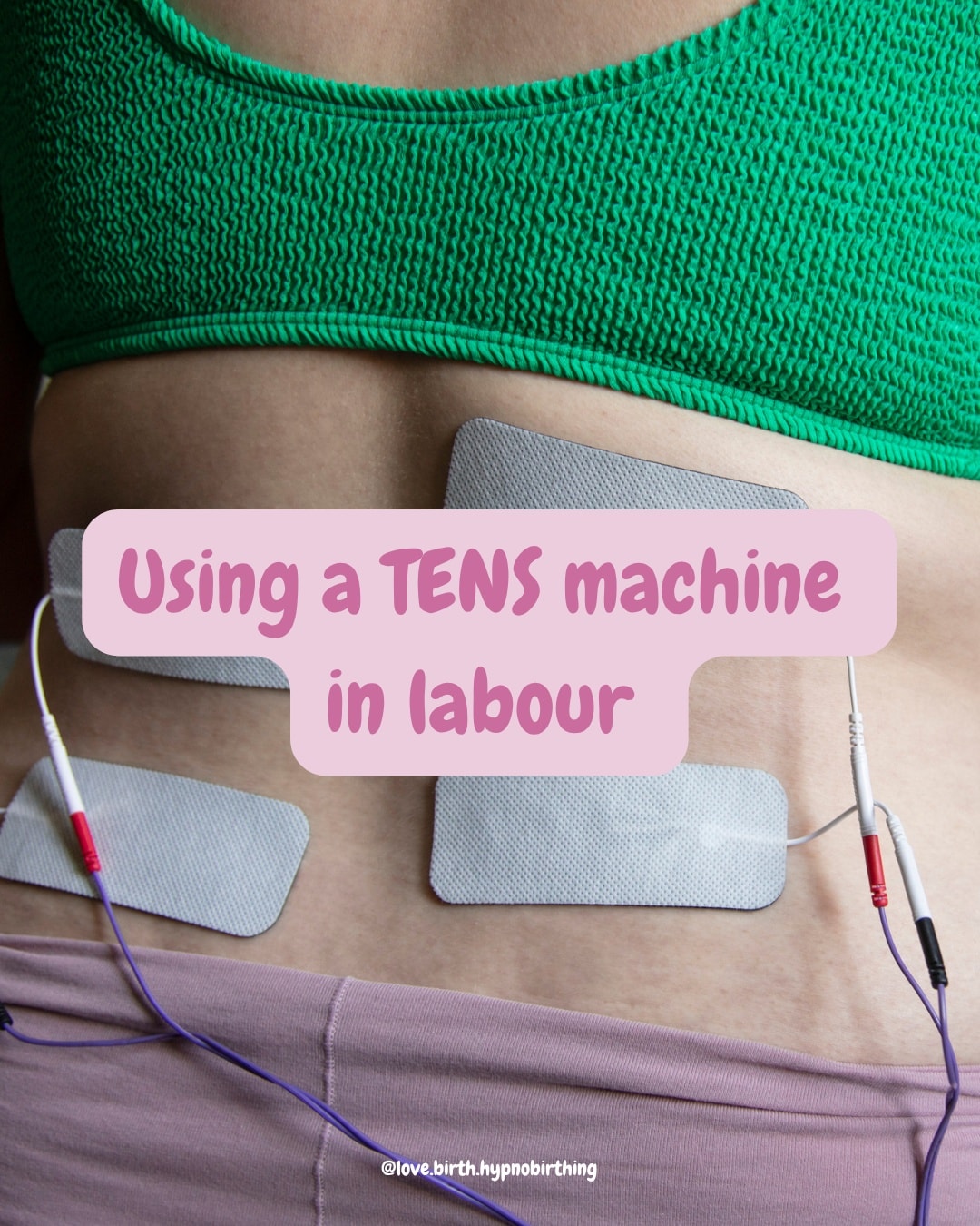 Have you thought about using a TENS machine in labour?
For such a simple thing, some people find them really helpful for coping with contractions.
You can buy them new from around £40-£50 or you can hire them from around £25. You can also look on FB and Vinted for a second hand bargain. Plenty of them go unused but if you're buying second hand you simply just buy new pads for them!
Don't forget to make sure you're buying a maternity specific one and to get some spare batteries!
#hypnobirthing #hypnobirthingburntwood #hypnobirthinglichfield #positivebirth #empoweredbirth #lichfieldbusiness #pregnant #staffordshirebusiness