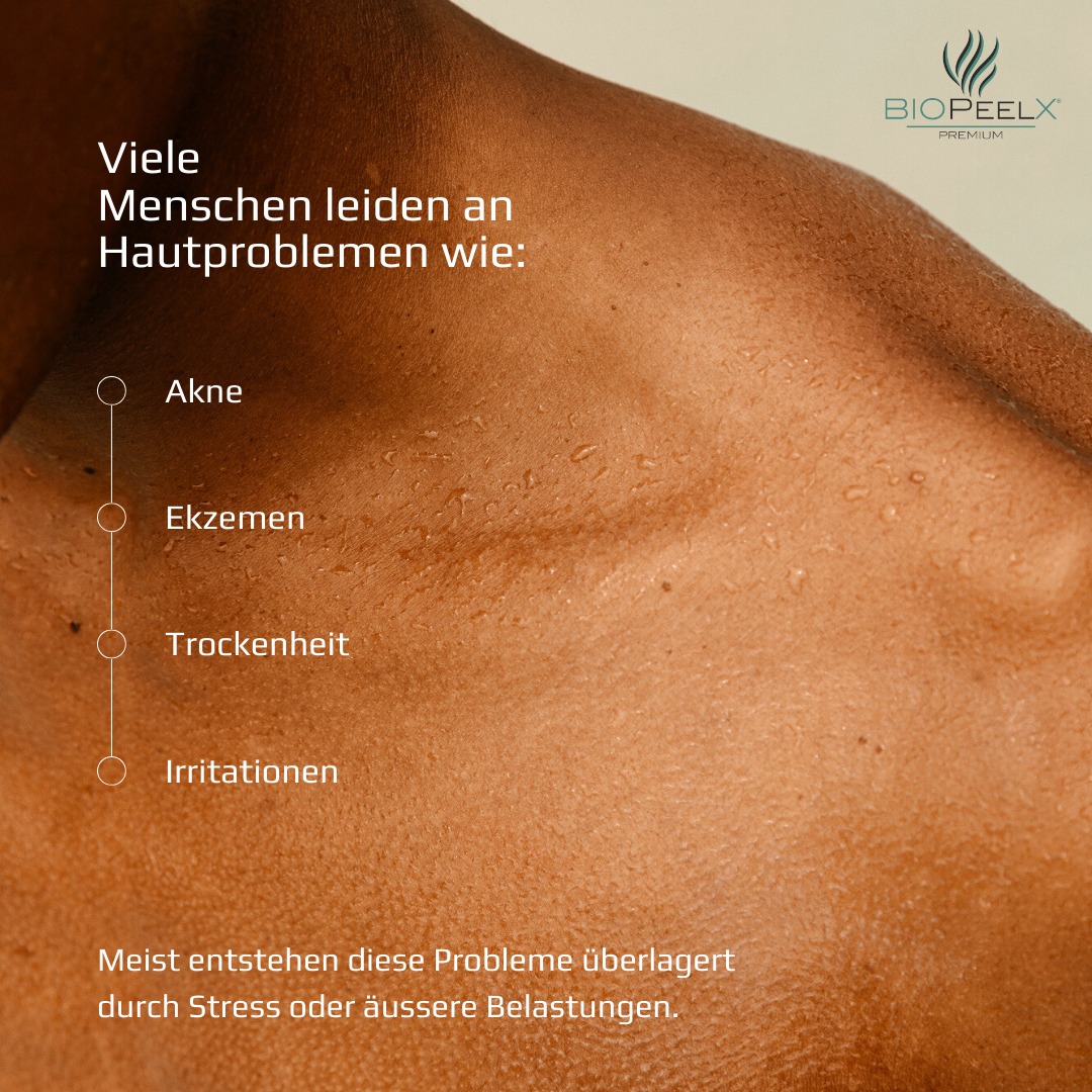 Viele Menschen leiden an Hautproblemen wie Akne, Ekzemen, Pilzinfektionen, Trockenheit oder Irritationen – meist überlagert durch Stress oder äussere Belastungen.
BiopeelX® nutzt Siliziumschwamm-Mikronadeln aus der Natur, kein Einsatz chemischer Bestandteile.
#biopeel #biopeelx #biopeeling #biopeelingtreatment #biopeeling #biopeelings #biopeelxpremium #algenpeeling