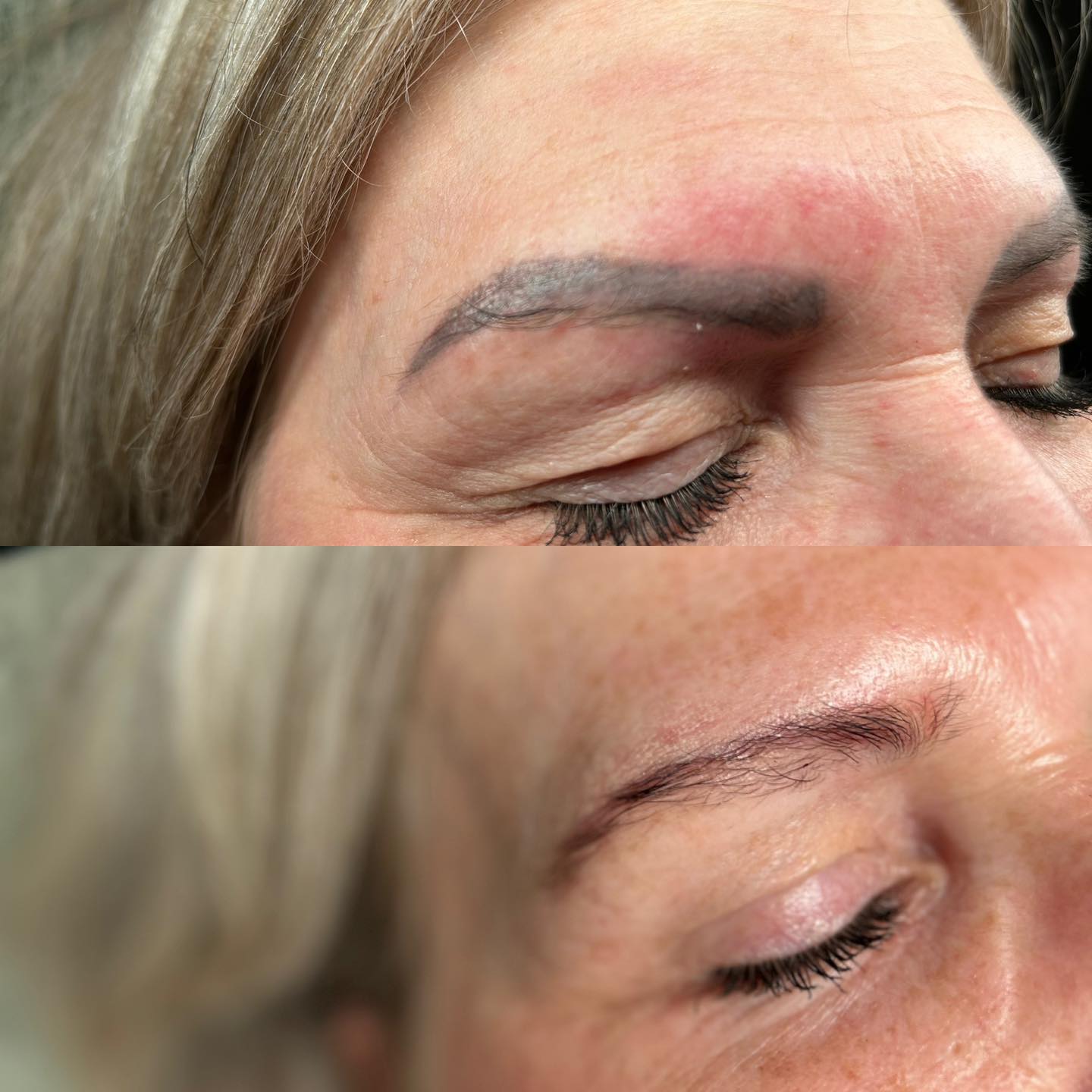 Fout gezette permanente make-up.
Helaas zien we het heel veel.
Mensen blijven er vaak mee rondlopen, omdat ze denken dat er niets aan te doen is.
Met onze veilige en krachtige picolaser, kunnen we permanente make-up en tatoeages verwijderen.
Maak een afspraak voor een gratis intake gesprek!
www.schoonheidssalonwilmameins.nl