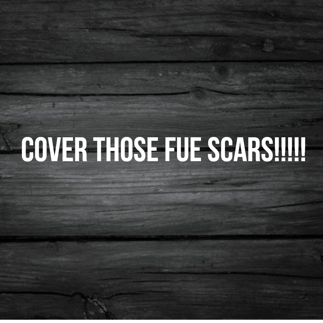 We cover scars too!!!!
Hair transplant scars will be a thing of the past.
Surgery scars are no more.
Scalp Micropigmentation is a pmu procedure that uses a method similar to a tattoo to replicate hair follicles on your scalp. No hair grows from this procedure.
At SMP Ireland:
We tailor each hairline to every individual client.
We restore the image of having a full head of hair
We only use the highest standard quality products to ensure you get the best look.
No bleeding, no swelling and no scabbing.
Any redness disappears within 24 hours.
Some of the things we tackle are the following:
Thinning hair
Receding hairlines
Add hair density
Create symmetry
Male pattern baldness
Female pattern baldness
Alopecia
Hair loss.
FUT and FUE scarring camouflage
If interested DM, text, call email or check my website for quotes.
All consultations are free and payment plans are available.
Please feel free to follow to see our customer transformations.
Based in Limerick city, Ireland serving Ireland.
#beboldnotbald #trusttheprocess #pmuireland #smpireland #limerickcity #limerick
#limerickbusiness #bald #hair #scalpmicropigmentationireland #hairloss #balding #beautyireland #aestheticireland #baldingsolutionireland #confidencerestored
#beauty #hairline #hairstyles #scars