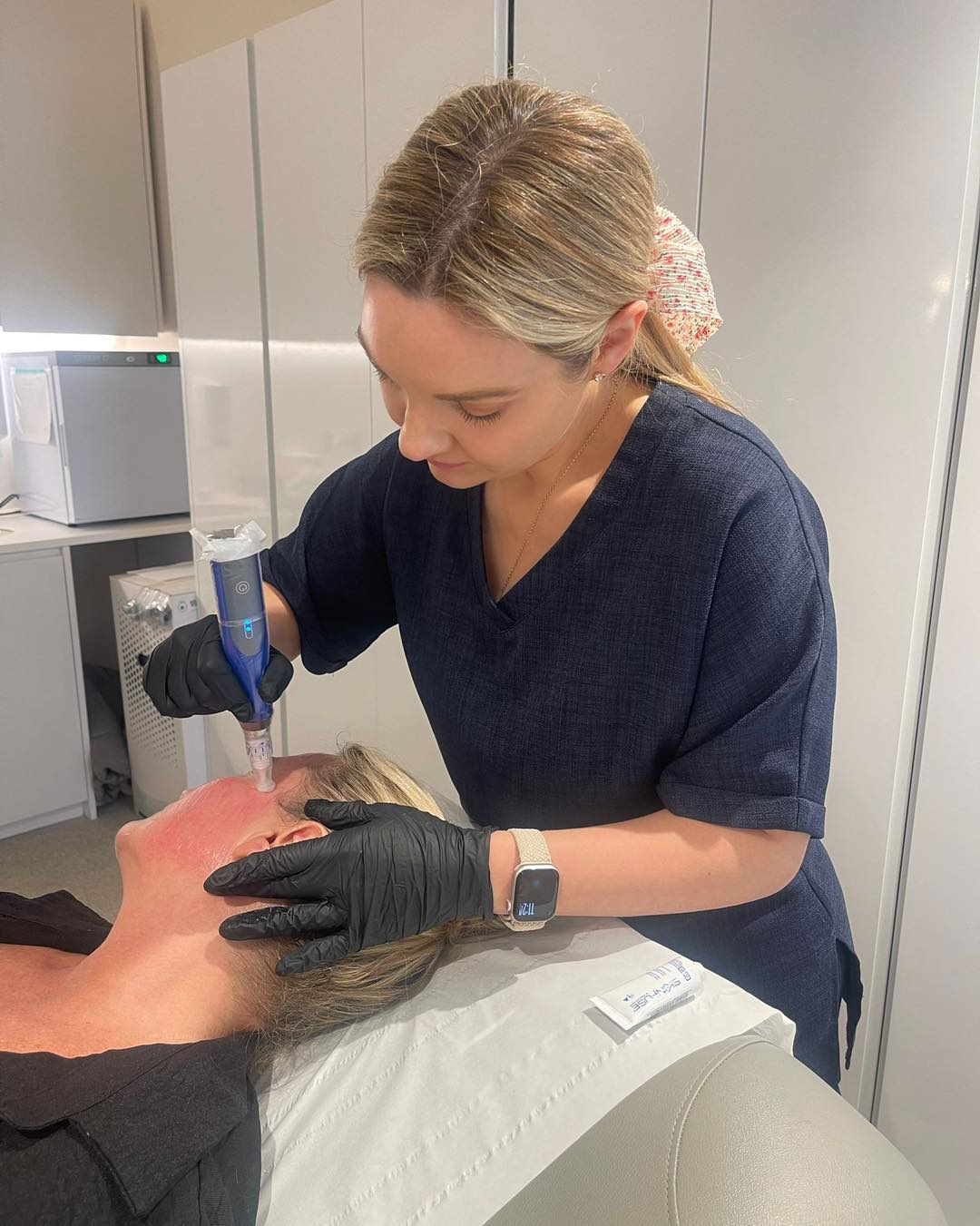 ✨ We’re so excited to be bringing professional microneedling to our clinic! ✨
Our team has completed advanced training in this innovative skin treatment—hailed as a game changer in the beauty industry for its ability to naturally rejuvenate the skin.
🔬 What is microneedling?
Microneedling uses ultra-fine, medical-grade needles to create tiny, controlled micro-channels in the skin. These microscopic “injuries” signal your body’s natural healing response, which:
• Triggers collagen and elastin production
• Increases cell turnover
• Enhances the absorption of active serums applied during treatment
💡 Benefits you can see:
• Firmer, plumper skin with improved elasticity
• Softer fine lines and wrinkles
• Noticeable reduction in acne scars and stretch marks
• Smaller-looking pores and smoother texture
• Brighter, more even skin tone over time
👩⚕️ Because our team is fully trained and continually upskilling, each session is delivered safely and precisely, tailored to your unique skin needs.
#Microneedling #SkinRejuvenation #CollagenBoost #AcneScarTreatment #HealthySkin #GlowingSkin
#glowingskin #glowingskintips #glowingskintipsnaturally