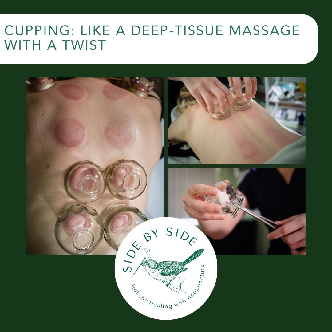 Cupping looks dramatic, feels soothing, and yes — sometimes leaves you looking like you’ve had a cuddle with an octopus 🐙.
But the truth? It gets blood + Qi moving, eases pain, reduces inflammation, and loosens cranky shoulders.
It’s not just for sore backs — I also use it for headaches, digestion, and general “stuck-ness.”
Opening 3rd November and to celebrate: £10 off your first November session.
👉 To book, email info@sbsacupuncture.com
#otford #otfordkent #kemsingmums #otfordvillage #sevenoakslifesfyle #sevenoakslifetyle #sevenoaksevents #kemsingvillage #sevenoaksliving #sevenoakscommunity #otfordvillagehub #sevenoaks #sevenoakslifestyle #sevenoaksmums #sevenoakslifestle #otfordvillagelife #sevenoakskent #kemsing #sevenoakslife