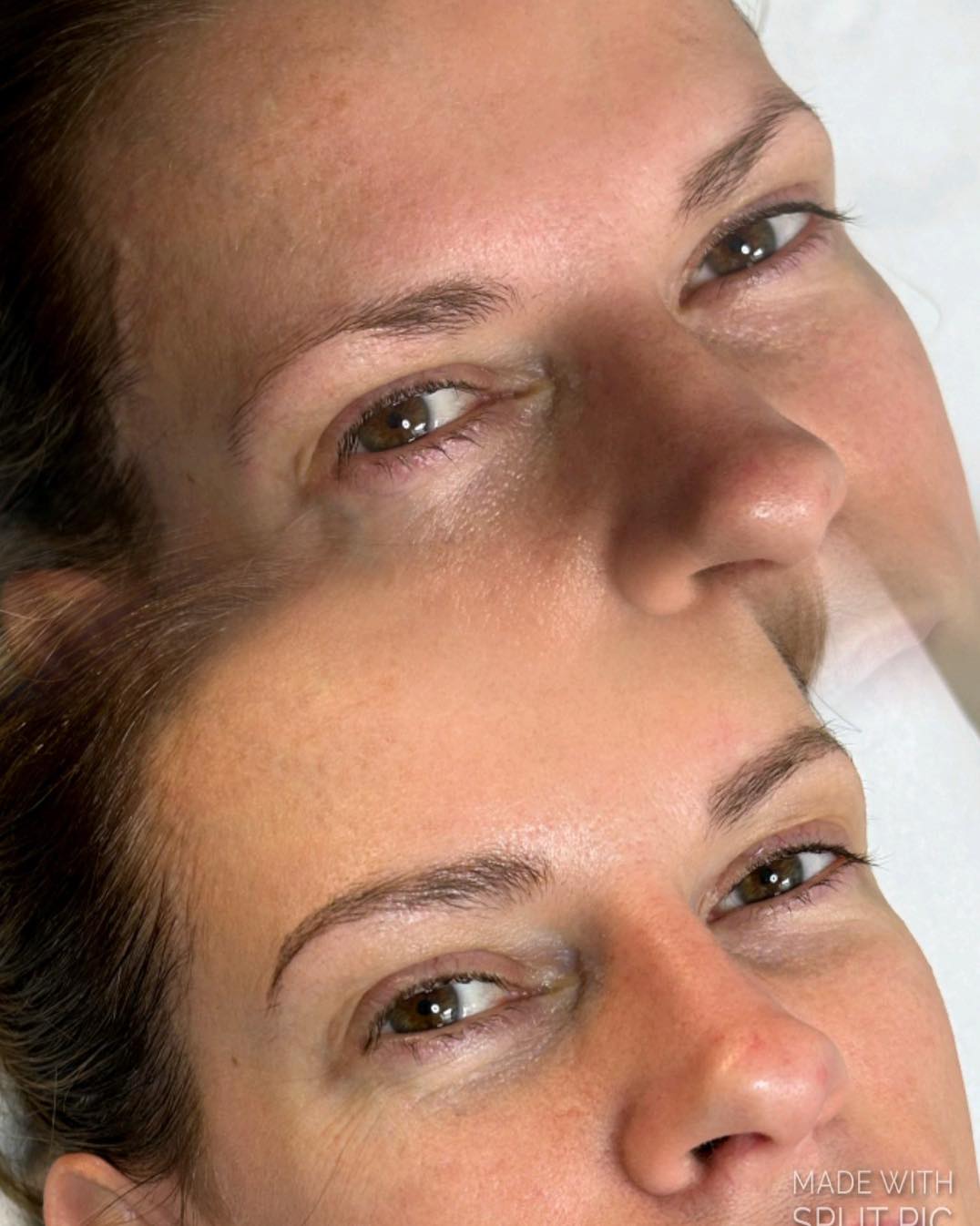 Before and healed after first session 🤩 incredible, natural result 😍