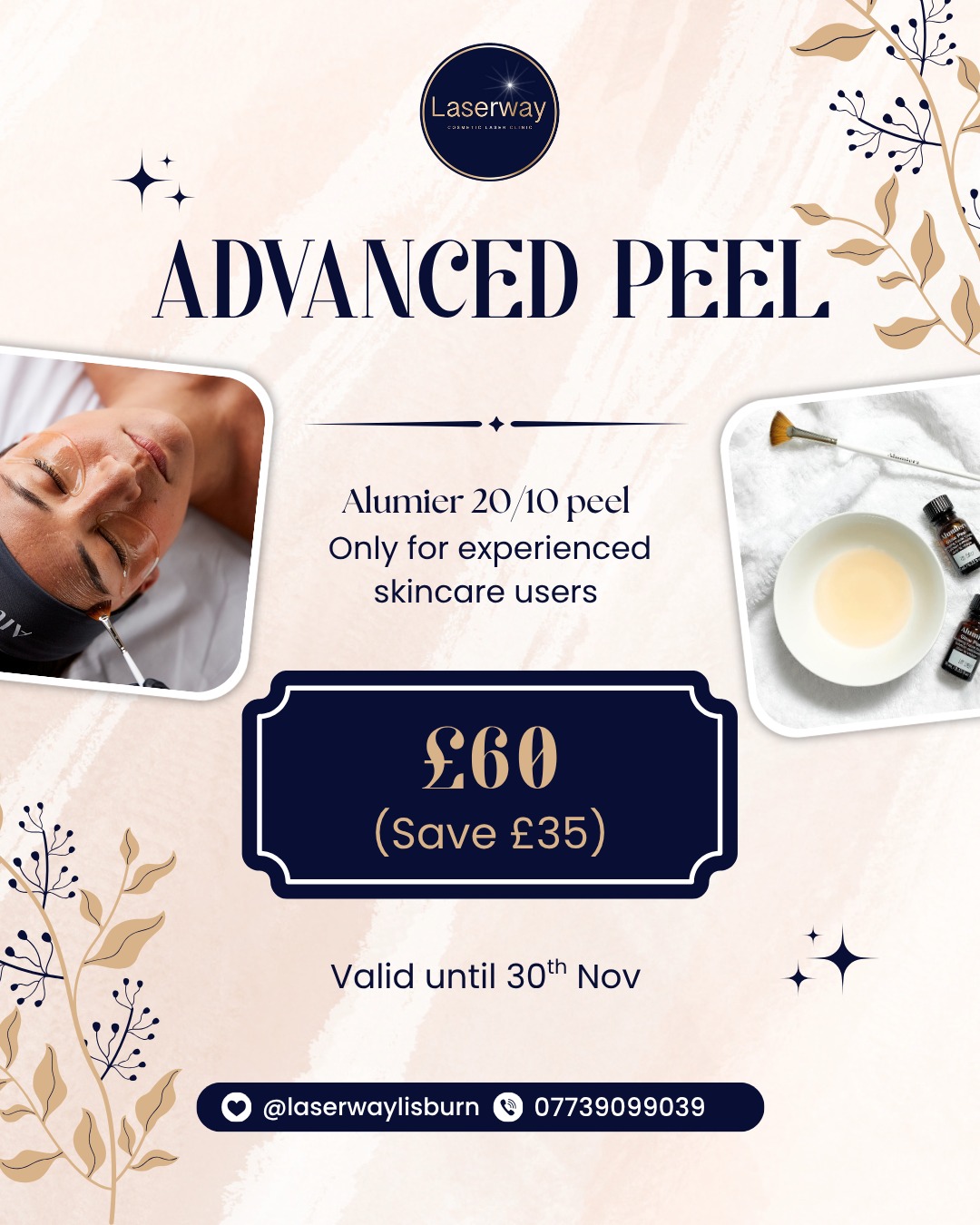 ✨ NOVEMBER SPECIAL OFFER ✨
It’s time to glow this season! 🍂
Enjoy our Advanced Alumier Peel for just £60 (usually £95)
This advanced-level chemical peel is not for beginners – it’s designed for experienced skincare users ready to take their results to the next level.
This powerful professional peel helps to:
🌿 Brighten dull, tired skin
💧 Smooth texture and refine pores
✨ Improve fine lines, acne, and pigmentation
🌸 Reveal a radiant, healthy complexion
Perfect for a winter skin refresh or pre-event glow!
📅 Offer valid until 30th November
📍 45 Eglantine Road, Lisburn BT275RQ
📞 Call or DM us to book your appointment — 07739099039
#AlumierMD #ChemicalPeel #SkinGlow #FacialTreatment #BeautyClinic #NovemberOffer #GlowingSkin