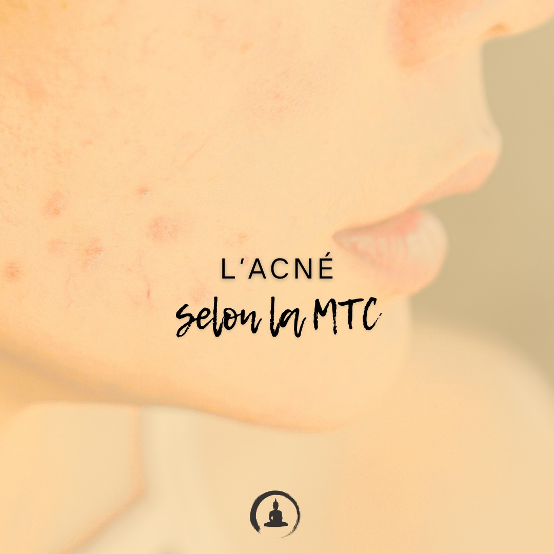 🌿 Découvrez la Médecine Chinoise avec Serge Romanato ! 🌿
Besoin de rééquilibrer votre énergie, soulager vos tensions ou améliorer votre bien-être ? ✨
📍 Cabinet Zen Garden - Carouge
🔹 Acupuncture | Fasciathérapie | Thérapies énergétiques
🔹 Approche holistique pour harmoniser corps & esprit
🔹 Prenez soin de votre santé naturellement
📲 RDV & infos sur 👉 www.cabinet-zengarden.org
💬 Vous avez déjà essayé la Médecine Chinoise ?
Dites-moi en commentaire ! ⬇️
#MédecineChinoise #Acupuncture #Fasciathérapie #BienÊtreNaturel #ZenGarden #Carouge ##essentialsoils #ÉnergieVitale #tao #cieletterre