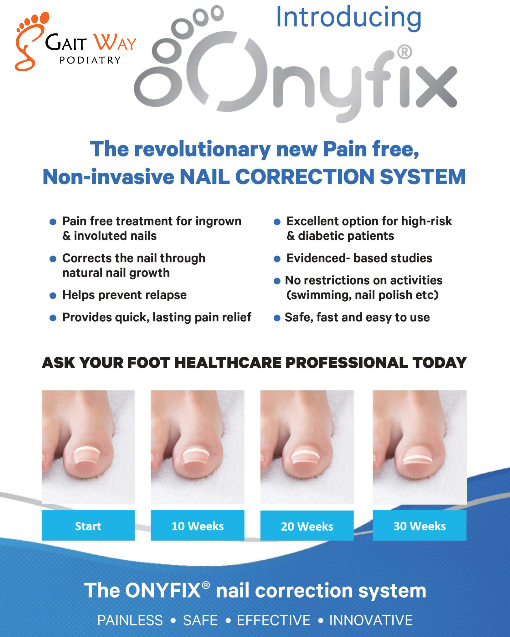 Ingrown nails are painful, usually occur on the big toe. Men tend to struggle with ingrown nails slightly more often than women. An ingrown nail occurs when the toenail grows sideways into the nail bed or the nail fold and thus deviates from its intended direction of growth.
Onyfix is a completely new approach to nail correction, fixing the nail in its proximal (closer to the body) shape, it prevents the nail from curling and growing inwards as it grows. The procedure is completely painless and permanent for the patient!
Onyfix is now available at Gaitway Podiatry - Call now for an appointment! (𝟬𝟳) 𝟯𝟯𝟴𝟱 𝟬𝟱𝟲𝟳