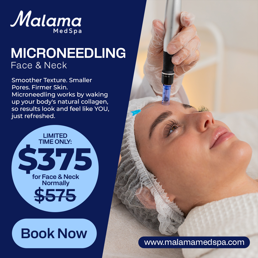 During this season of giving, prioritize your own well-being and indulge in a radiant holiday glow. Take advantage of our limited-time offer to revitalize your skin, addressing texture, pores, and acne scarring with FDA-approved Skinpen Microneedling, available for $375. DM or Text 480-690-1880 to book!!!