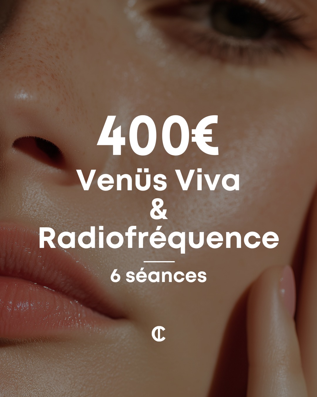 Décembre est le moment parfait pour préparer votre peau avant les fêtes 🎄
✨ Cure Venüs Viva / Radiofréquence – 6 séances : 400€
Pour :
• Raffermir la peau
• Lisser le grain
• Réduire les cicatrices & irrégularités
• Booster l’éclat et la tonicité
Une cure complète pour retrouver une peau plus nette, plus ferme, plus lumineuse ✨
📍 Institut C – Lyon 2
📲 Réservation sur Planity. Lien dans la bio.
#institutclyon #venusviva #radiofréquence #soinantiage #raffermissement #lyonbeauty #skinroutine #beauteholistique #peauferme #decembre2024