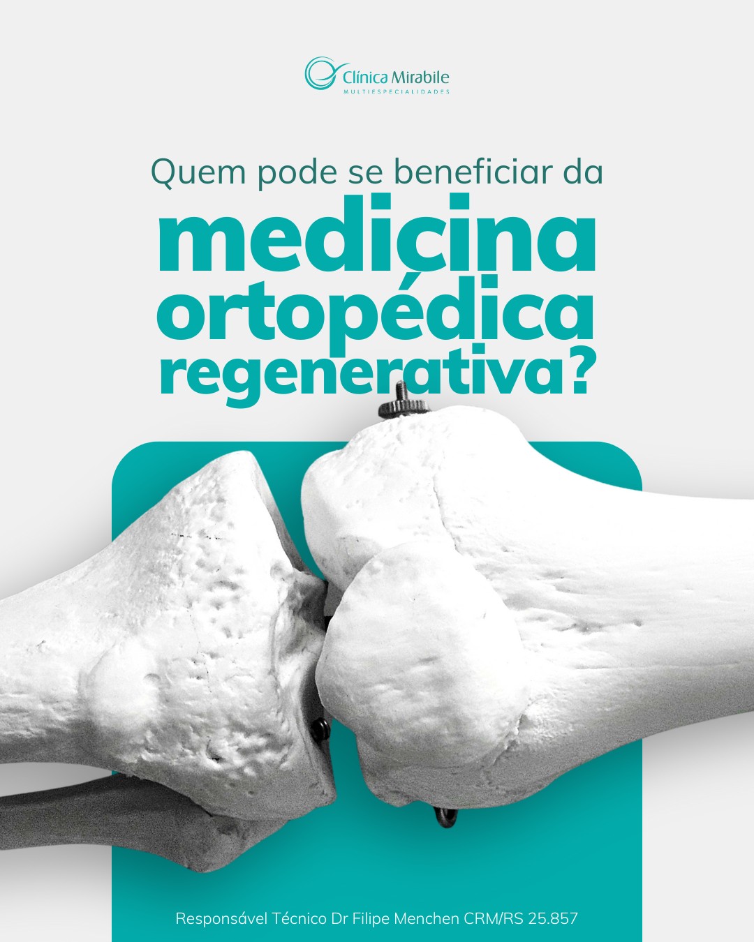 A medicina ortopédica regenerativa utiliza recursos do próprio corpo para estimular a regeneração de tecidos e auxiliar na recuperação de lesões. 🩺
O tratamento pode beneficiar pacientes de diferentes idades e condições, sempre com avaliação individualizada.
Os resultados são graduais, refletindo o processo natural de reparo do organismo.
👉 O acompanhamento médico é indispensável para indicar o tratamento adequado e monitorar sua evolução.
-
#clinicamirabile #clinicamultidisciplinar #portoalegre #medicinaregeenerativa
