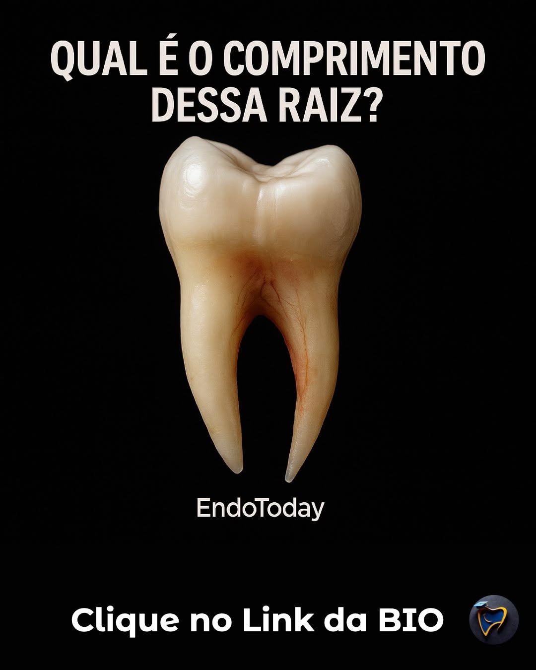 🔍 Precisão não é detalhe — é protocolo.
O controle de comprimento continua sendo um dos pilares mais críticos da Endodontia moderna. Erros milimétricos podem comprometer a limpeza, favorecer extrusões, gerar pós-operatórios desnecessários e reduzir a previsibilidade do tratamento.
Profissionais que dominam essa etapa alcançam resultados mais consistentes, menos complicações e maior segurança clínica.
🦷 A Endodontia que dá certo começa no comprimento certo.
📣 Agora me conte:
👉 Você sabe a diferença entre comprimento real de trabalho com controle no comprimento em Endodontia ?
Não Sabe? Clique no link da Bio.
📌 Comente aqui!
🔖 Salve este post para revisar seus passos na próxima sessão clínica.
📤 Compartilhe com um colega que precisa reforçar esta etapa essencial.
#endodontia #odontologia #endodontics #dentista #dentistry #brasil #endolovers #odonto #endodontiamicroscopica #tratamentodecanal #endo #dentistas #saopaulo #sp #endodoncia #endodontic #dentist #endodontiabrasil #endodontiauberlândia #endodontiaportovelho #aorp74anos #dicasendodonticas #unaerp #ufu #unitri #faculdadepitágoras #uniube #uspribeirao #faculdadeestácio #uspribeirao
@abo.rondonia @hdensinosoficial l @aorp1946 @apcdararaquara
@thaischriscunha @chimenycurtiazzuz @pascoalinodoc @martinmeirelles @daniedison