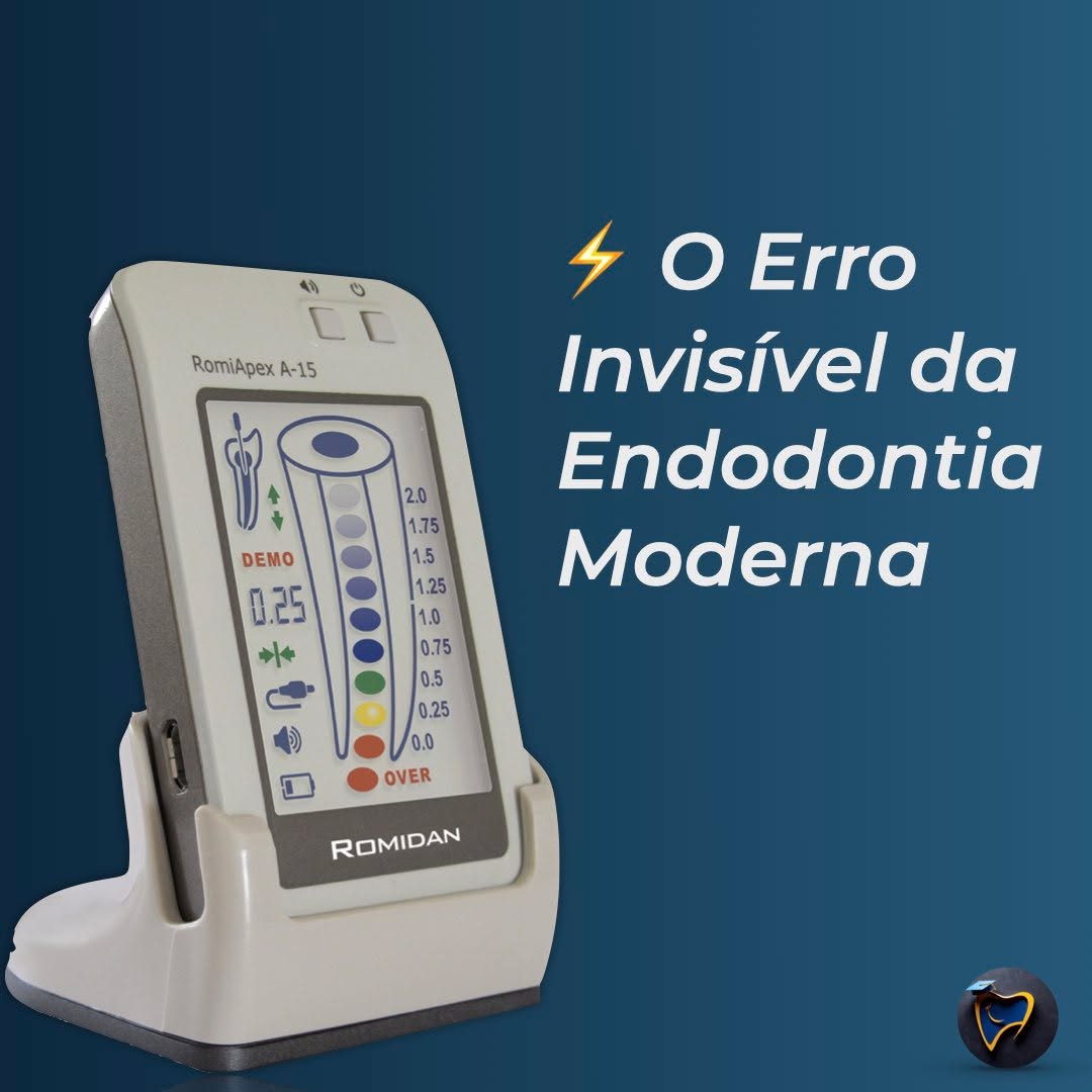Você já parou para pensar que nenhum canal radicular é igual ao outro?
E que confiar em “médias” ou tamanhos arbitrários pode comprometer silenciosamente o seu resultado?
A maior parte dos erros em determinação de comprimento, bloqueio apical, degraus e transportes não acontece por falta de conhecimento, mas sim por hábitos clínicos que não acompanham a complexidade real da anatomia.
Neste carrossel, reuni as lições mais importantes para quem deseja elevar sua precisão apical:
✔️ Por que não existe canal “padrão”
✔️ Por que o EAL é indispensável
✔️ Como um bom acesso muda completamente as leituras
✔️ O papel crítico dos lubrificantes na negociação
✔️ Como estabilizar sinais instáveis
✔️ Por que radiografias para comprimento podem enganar
✔️ E o método mais seguro para máxima previsibilidade
Se você deseja diminuir retratamentos, aumentar segurança, acelerar sua curva de aprendizado e dominar definitivamente o uso do EAL, este conteúdo é para você.
👉 Quer entender cada detalhe com demonstrações práticas e explicações completas?
A leitura aprofundada está no blog da EndoToday.
🔗 Link na bio
📚 EndoToday — Ciência, precisão e prática clínica real.
#endodontia #odontologia #endodontics #dentista #dentistry #brasil #endolovers #odonto #endodontiamicroscopica #tratamentodecanal #endo #dentistas #saopaulo #sp #endodoncia #endodontic #dentist #endodontiabrasil #endodontiauberlândia #endodontiaportovelho #aorp74anos #dicasendodonticas #unaerp #ufu #unitri #faculdadepitágoras #uniube #uspribeirao #faculdadeestácio #uspribeirao
@abo.rondonia @hdensinosoficial @aorp1946 @apcdararaquara
@thaischriscunha @pascoalinodoc @martinmeirelles @daniedison