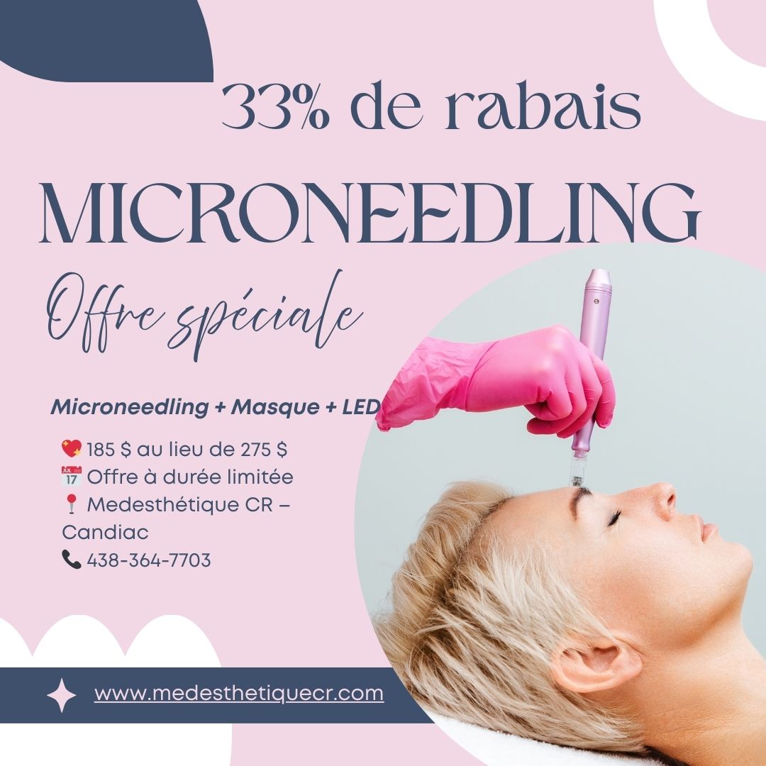 🎉 OFFRE MICRONEEDLING – 33% DE RABAIS ! 🎉
Le moment parfait pour prendre soin de votre peau 💆♀️✨
👉 Microneedling + Masque + LED : 185 $ seulement ! (valeur 275 $)
Un soin complet pour révéler une peau plus douce, plus lisse et visiblement revigorée 🌸
⚡️ Offre limitée — premiers arrivés, premiers servis !
📍 Medesthétique CR · Candiac
📞 438-364-7703
💌 Réservez via Messenger