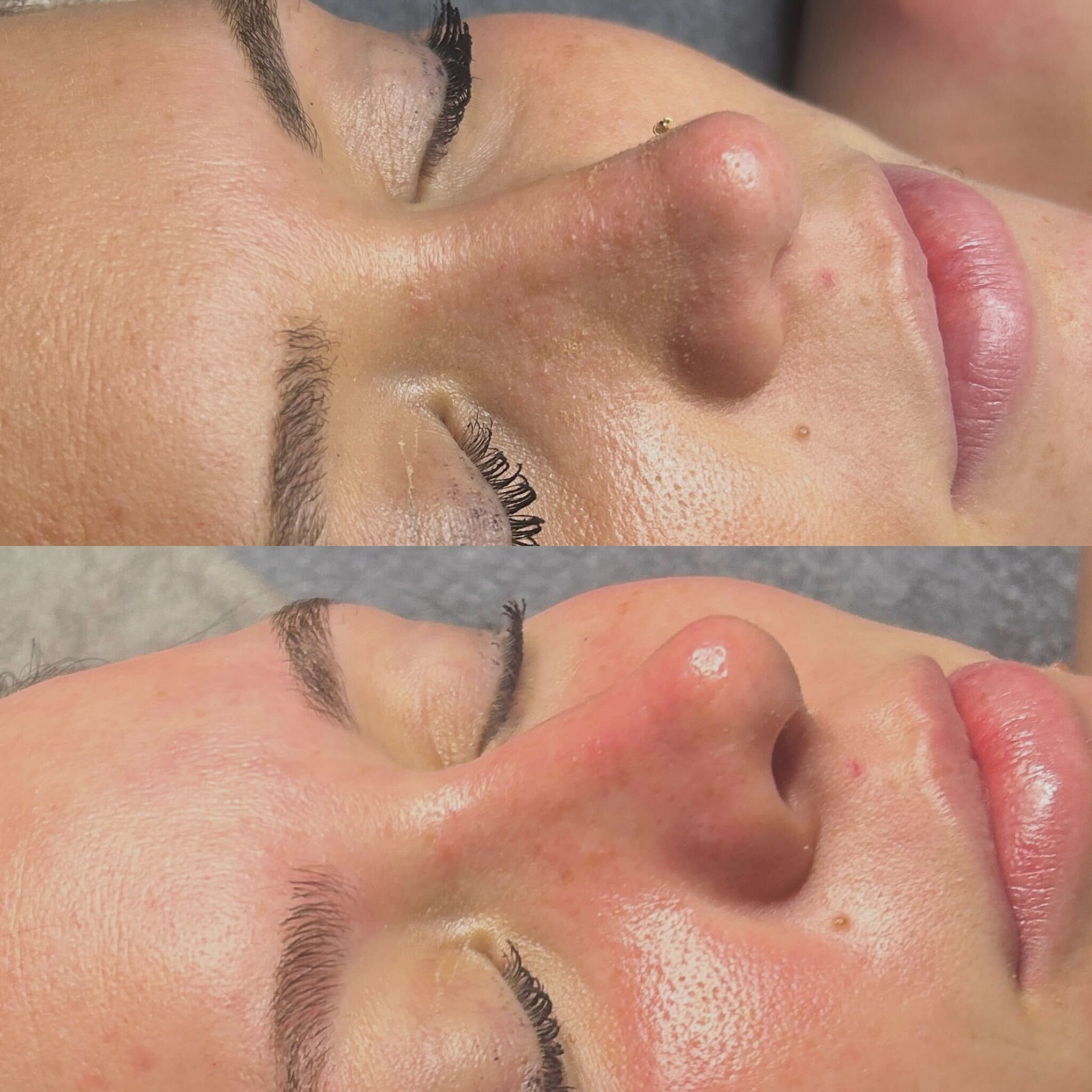 ✨ A little reset goes a long way. This facial focused on nourishment and calming the skin, leaving everything softer, smoother, and more refreshed.
If your skin’s been asking for a breather, this is your sign to book a moment for yourself at our Noblesville location.
#cloud9hairandspa #indyhair #facialservices