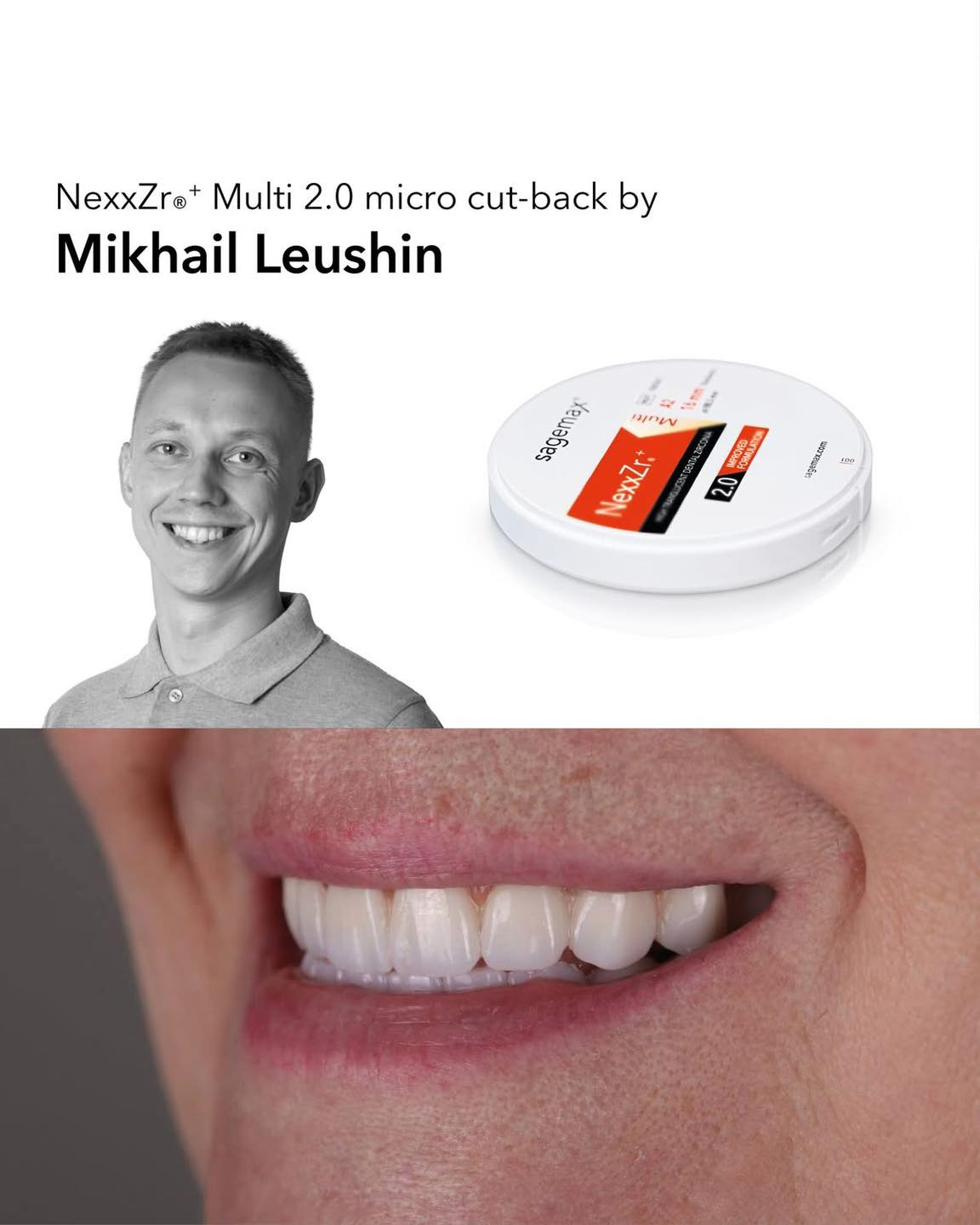 Giving someone a new smile-that's what Mikhail did with his esthetic NexxZr+ Multi 2.0 restoration.
Check out the full case here: https:// sagemax.com/community/
Skills Tech Dental Lab
@sagemax official
خصومات خاصة بمناسبة آخر العام !
✉️ ابعتلنا رسالة واعرف تفاصيل العرض دلوقتي !
For more information on our products and for our latest promotions call us on
: 24513870 - 24513874
لمزيد من المعلومات و للاستعلام اتصل بنا : 24513870 - 24513874
#sagemax #dentalwork #dentaltechnician #smile #dentistry #zahntechnik #عيد_و_كبريته #زركونيا_ديسك #جودة_تثق_بها #جودة_عالية