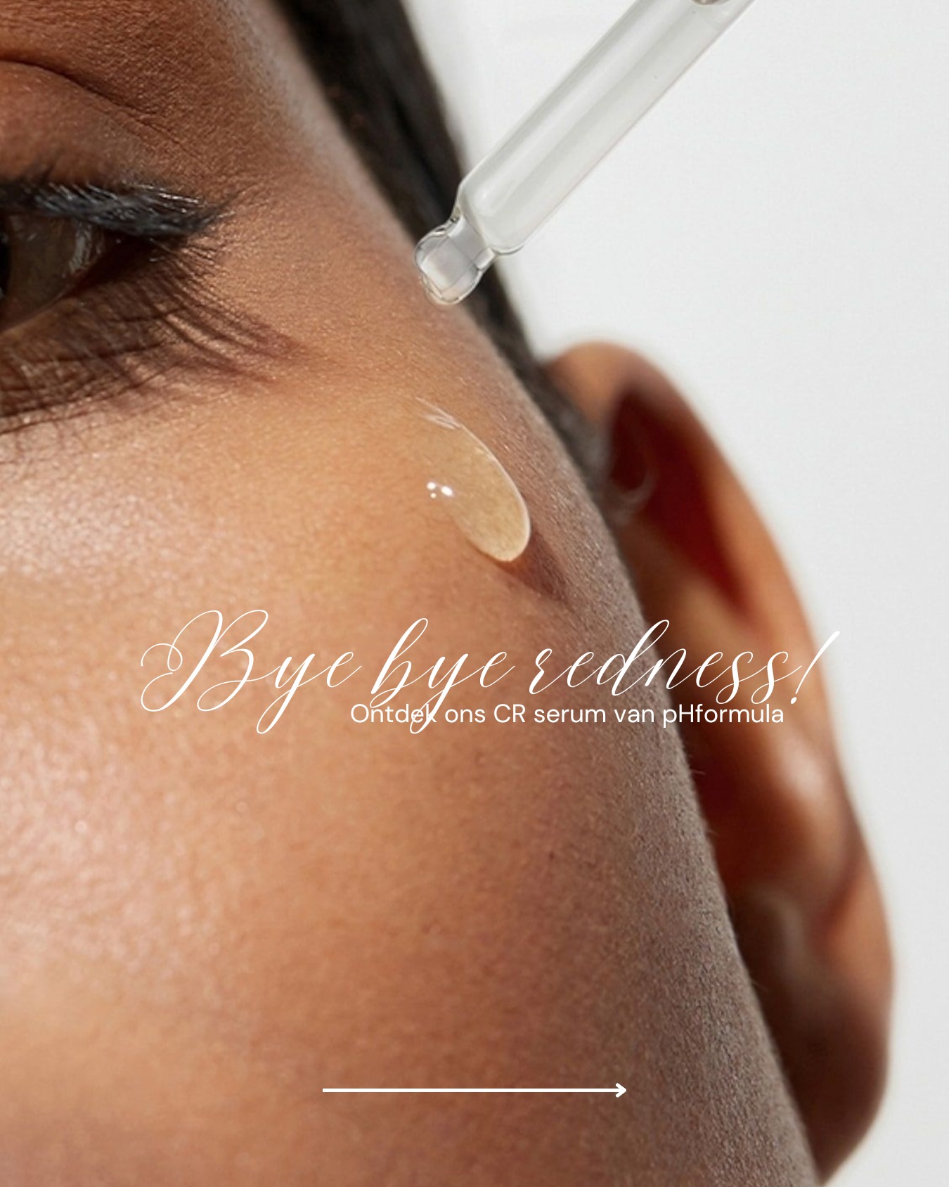 Soms neemt je huid ineens alle aandacht op.
Roodheid, gevoeligheid, een trekkerig of branderig gevoel… en plots kijk je nét iets kritischer in de spiegel dan je zou willen. Dat zijn van die momenten waarop je zelfvertrouwen even wankelt. 🤍
Maar laat me dit zeggen: je staat hier niet alleen in.
Het CR Recovery Serum van pHformula is er precies voor die dagen. Niet om je huid te “fixen”, maar om haar tot rust te brengen, te beschermen en opnieuw veilig te laten aanvoelen. Zacht, maar doelgericht. Kalm, maar krachtig.
✨ Dit serum is dagelijkse comfortcare voor wie leeft met rosacea, roodheid of een verstoorde huidbarrière, en gewoon weer wil ademen in haar eigen huid.
💛 Wat het voor jouw huid doet:
• Kalmeert gevoeligheid en prikkeling
• Verzacht zichtbaar roodheden en ontstekingen
• Versterkt en herstelt de huidbarrière
• Hydrateert diep en langdurig
• Beschermt tegen externe stressfactoren
Met o.a.:
🌟 Vitamine C – voor een zachte, gezonde glow
🌟 Hyaluronzuur – voor intens comfort en hydratatie
🌟 Antioxidanten – om je huid te beschermen tegen invloeden van buitenaf
Gebruik het ‘s ochtends en ‘s avonds op een gereinigde huid en voel hoe je huid langzaam weer ontspant. Rustiger. Zachter. Veiliger.
Want wanneer je huid zich goed voelt, volgt je zelfvertrouwen vanzelf. 🤍
Verkrijgbaar via www.purelle.be of kom langs voor persoonlijk advies. Ik help je met liefde verder.
Veel liefs,
Lien