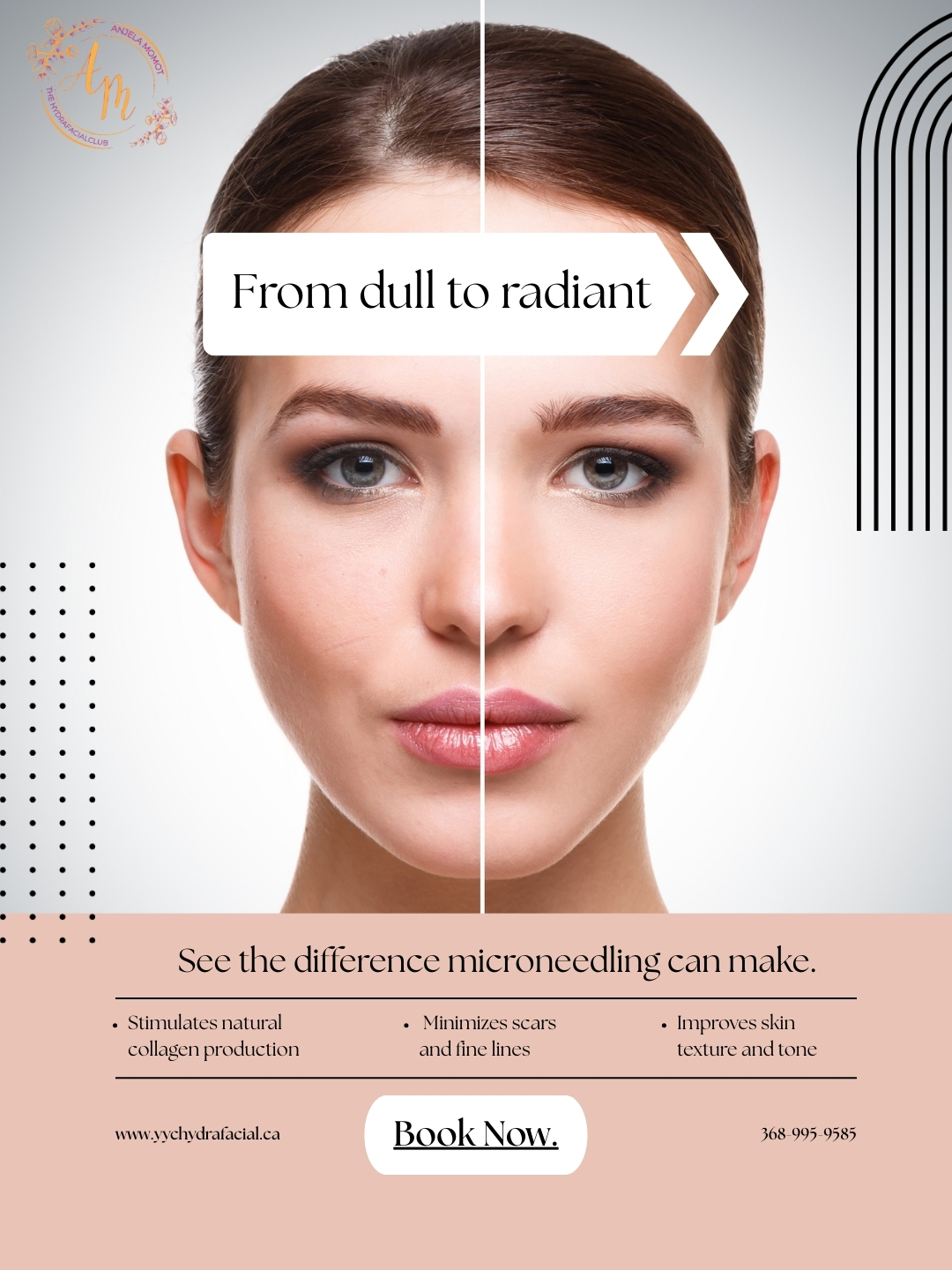 ✨ Microneedling at HYDRAFACIAL CLUB Calgary ✨
Looking to improve skin texture, tone, and overall glow in 2026?
Microneedling is one of the most effective treatments for skin renewal.
✔️ Boosts collagen & elastin
✔️ Improves fine lines and wrinkles
✔️ Reduces acne scars & enlarged pores
✔️ Enhances skin firmness and radiance
📅 Now booking Microneedling treatments for 2026
🌐 www.yychydarfacila.ca
📞 368-995-9585
#Microneedling #SkinRejuvenation #CollagenBoost #CalgarySkin #YYCSkincare
#GlowingSkin #HydrafacialClub #HydrafacialClubCalgary #YouthfulSkin #SkinGoals2026
#SmoothSkin #AcneScarTreatment #FineLineTreatment #CalgaryBeauty #HealthySkin