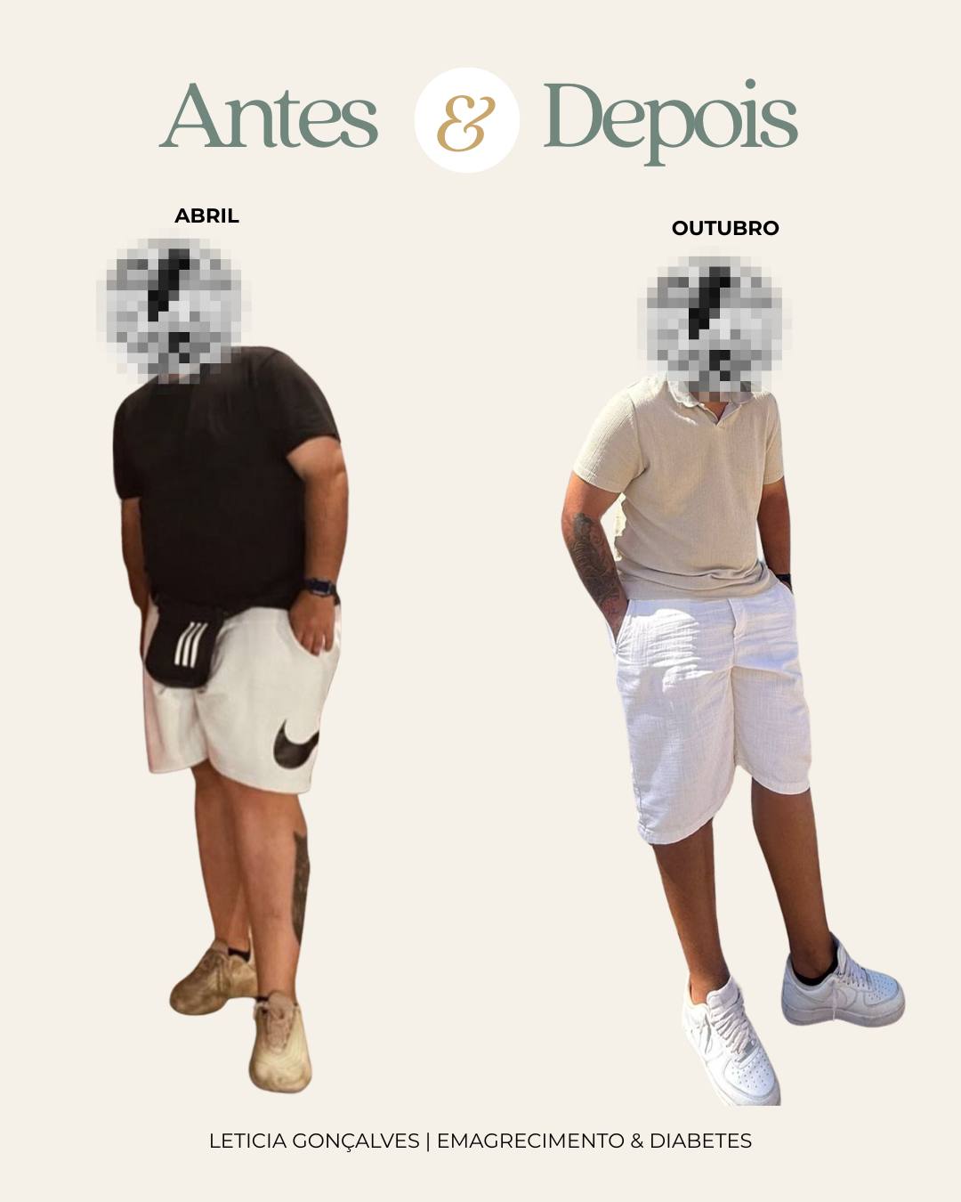 Antes & Depois ✨�
Não é apenas uma mudança no corpo, é uma mudança de hábitos, de relação com a comida e de compromisso com a saúde.
Este resultado (emagrecimento de cerca de 30KG, redução de CINTURA DE 25 CM, 8 níveis de GORDURA VISCERAL e de cerca de 10% DE MASSA GORDA EM 7 MESES), é fruto de acompanhamento nutricional personalizado, consistência e escolhas ajustadas à realidade de cada pessoa.
Sem dietas milagrosas, sem extremismos. Com equilíbrio, consciência e foco no bem-estar a longo prazo.
Se também quer iniciar o seu processo de forma segura e sustentável, estou aqui para o acompanhar 🤍
�📩 Marcação de consultas por mensagem privada ou através do email: leticia.c.v.goncalves@gmail.com