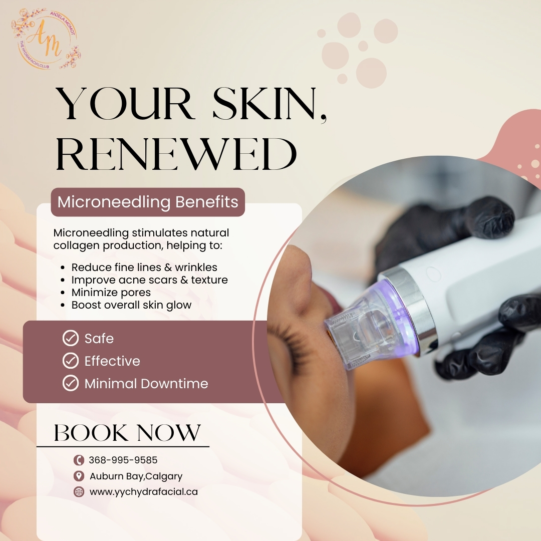 💎 Healthy skin doesn’t happen by chance — it’s planned
Microneedling at HYDRAFACIAL CLUB Calgary helps your skin regenerate naturally, revealing a smoother, fresher, more youthful appearance.
Professional care. Personalized treatments. Real results.
📍 Calgary
📅 2026 appointments now available
🌐 www.yychydarfacila.ca
📞 368-995-9585#Microneedling #SkinRejuvenation #CollagenBoost #CalgarySkin #YYCSkincare
#GlowingSkin #HydrafacialClub #HydrafacialClubCalgary #YouthfulSkin #SkinGoals2026
#SmoothSkin #AcneScarTreatment #FineLineTreatment #CalgaryBeauty #HealthySkin#Microneedling #SkinRejuvenation #CollagenBoost #CalgarySkin #YYCSkincare#GlowingSkin #HydrafacialClub #HydrafacialClubCalgary #YouthfulSkin #SkinGoals2026#SmoothSkin #AcneScarTreatment #FineLineTreatment #CalgaryBeauty #HealthySkin