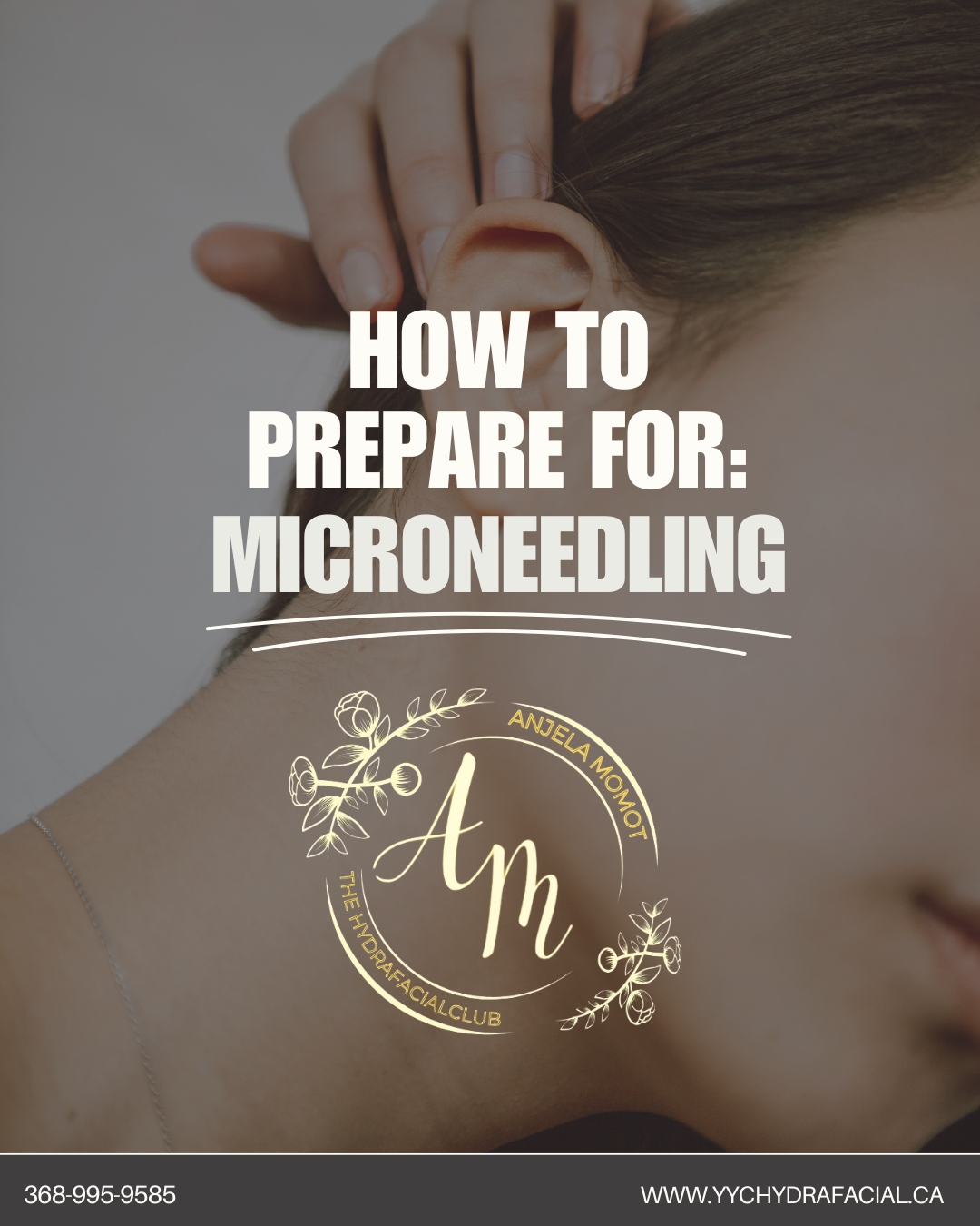✨ Getting Ready for Microneedling at HYDRAFACIAL CLUB Calgary ✨
Microneedling is a powerful treatment that helps your skin look smoother, firmer, and more radiant — but preparation is key for the best results.
Here’s how to get ready:
1️⃣ Avoid Sun & Tanning – Protect your skin at least 48 hours before your session.
2️⃣ Skip Retinoids & Exfoliants – Stop using strong skincare products 2–3 days prior.
3️⃣ Stay Hydrated – Drink plenty of water for healthier, plump skin.
4️⃣ Avoid Alcohol & Blood Thinners – This reduces the risk of bruising.
5️⃣ Clean Skin Only – Arrive with a fresh, makeup-free face.
💡 Our specialists will guide you through every step for a safe, comfortable, and effective treatment.
📅 Book your 2026 Microneedling appointment today
🌐 www.yychydarfacila.ca
📞 368-995-9585
#Microneedling #MicroneedlingPrep #SkinCareTips #CalgarySkin #YYCSkincare #HydrafacialClub #HydrafacialClubCalgary #GlowingSkin #HealthySkin #SkinGoals2026#Microneedling #SkinRejuvenation #CollagenBoost #CalgarySkin #YYCSkincare
#GlowingSkin #HydrafacialClub #HydrafacialClubCalgary #YouthfulSkin #SkinGoals2026
#SmoothSkin #AcneScarTreatment #FineLineTreatment #CalgaryBeauty #HealthySkin