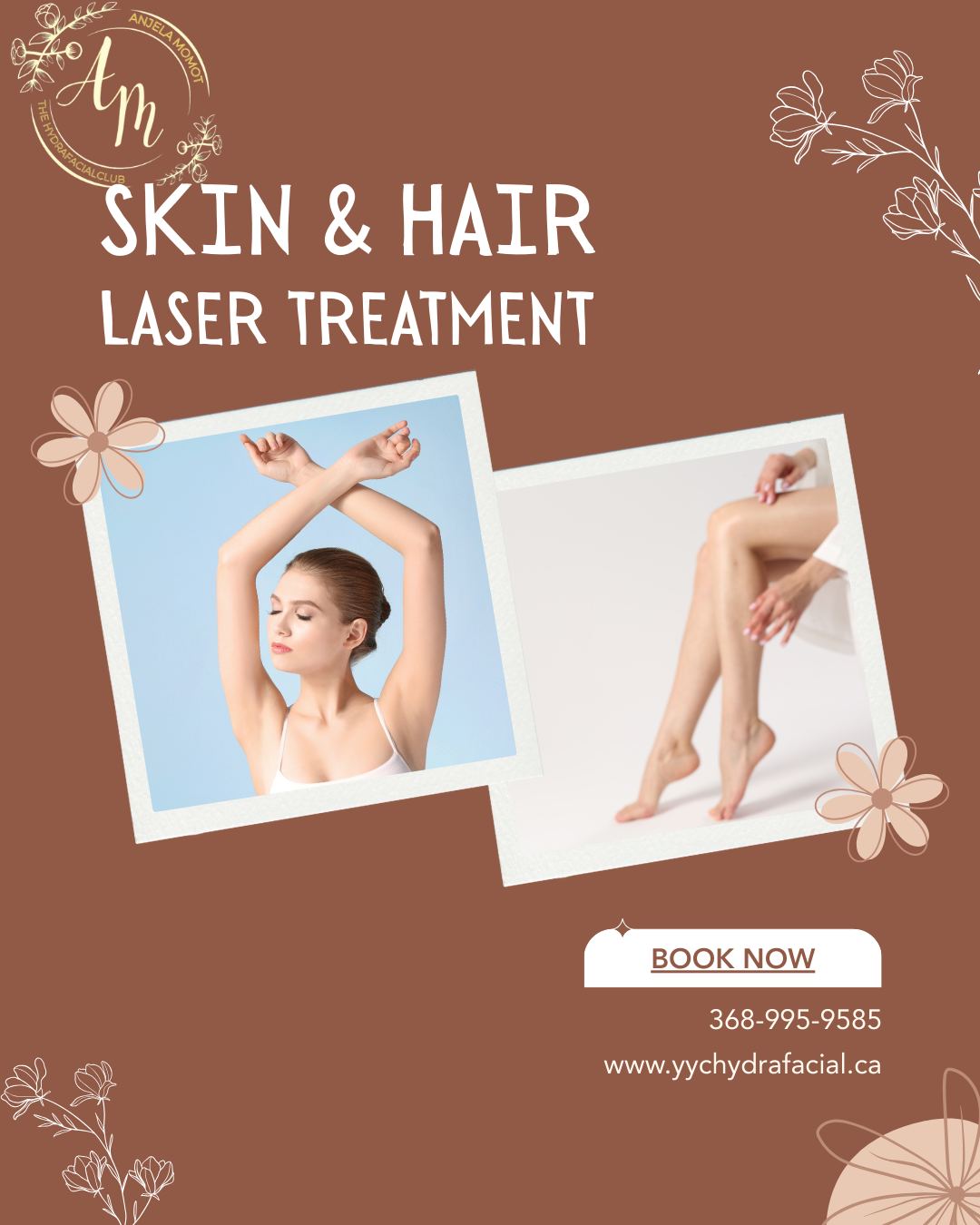 Say Goodbye to Shaving & Waxing
Tired of constant shaving, painful waxing, and irritated skin?
Laser Hair Removal offers a long-term solution by targeting the hair follicle directly, helping reduce hair growth over time.
✔️ Smoother skin
✔️ Less irritation
✔️ Long-lasting results
📍 Calgary
🌐 www.yychydarfacila.ca
📞 368-995-9585
#LaserHairRemovalCalgary #YYCLaser #HydrafacialClub #CalgaryAesthetics #SmoothSkin
#NoMoreShaving #WaxFree #LaserTreatment #YYCBeauty #PremiumSkincare
#SkinCareClinic #HairFreeSkin #SelfCareCalgary #LaserCare #CalgarySkin