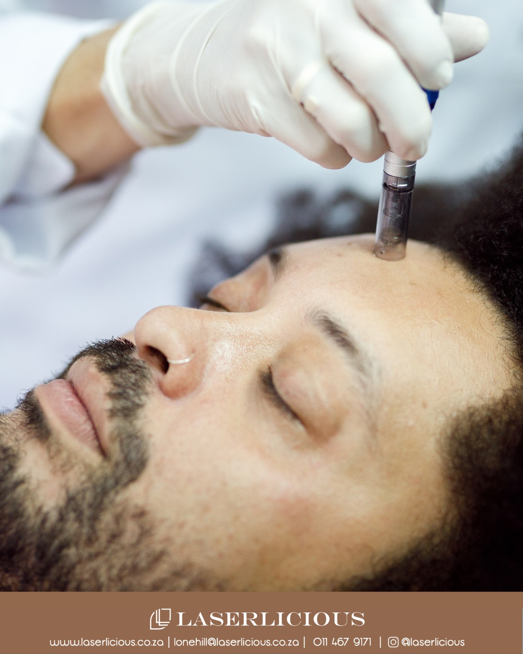 Microneedling that works with your skin, not against it.
This treatment is ideal for improving the appearance of fine lines, pigmentation, acne scarring and uneven texture. With adjustable needle depths and faster penetration than traditional rollers, each treatment is precisely tailored for optimal results and minimal downtime.
Healthy skin starts beneath the surface.
📞 Call Laserlicious on 011 467 9171 / WhatsApp 083 490 9524 / info@laserlicious.co.za to find out more, or to make a booking today.
