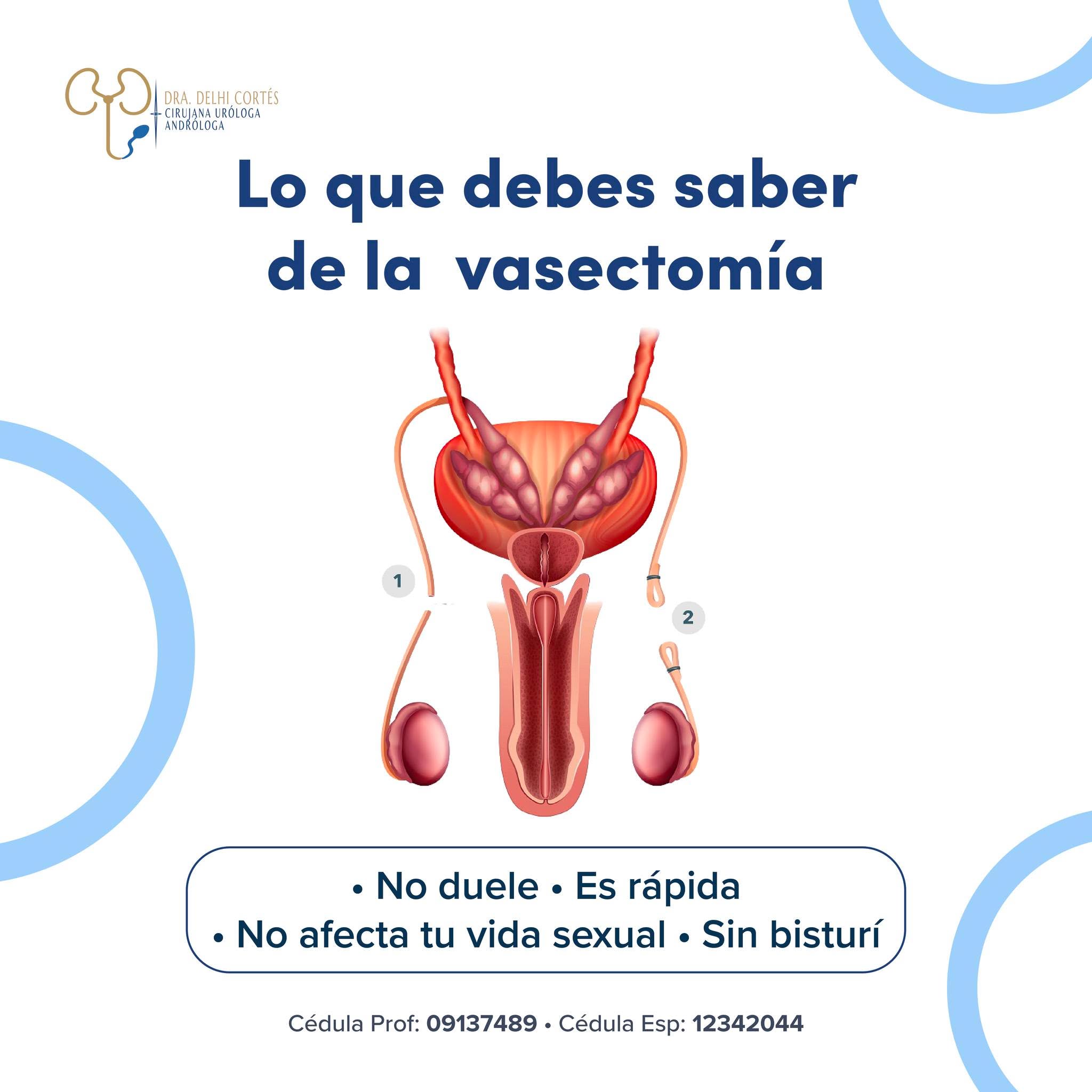 La Dra. Delhi Cortés realiza vasectomías con técnicas precisas, rápidas y con mínima molestia. 💙
Para más información agenda tu cita
📞Teléfono: 222 227 2713
✅WhatsApp: 561 213 3757
📍Dirección:
Periférico Ecológico 3507, int. 1229, Col. Emiliano
Zapata, San Andrés Cholula
Horarios:
🕣�Martes y jueves de 16:00 a 20:00 hrs
🕣Sábados de 10:00 a 14:00 hrs
👩🏼⚕️Dra. Delhi Cortés
Especialidad en urología, C.P. 12342044
Alta especialidad en Andrología
Certificación del consejo Mexicano de Urología, 1787
Aviso funcionamiento: 2421055056X00108
Aviso Publicidad: 2421052002A0008