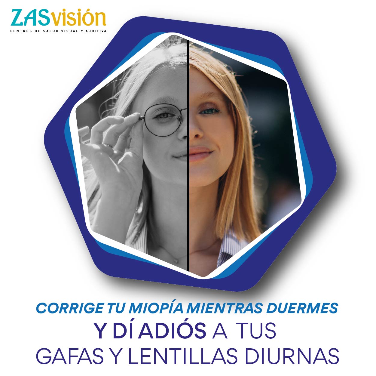 🌙 Corrige tu visión mientras duermes
👁️✨ Y despierta viendo con total claridad
Las lentillas Orto-K (ortoqueratología) se utilizan por la noche mientras duermes 💤
Moldean suavemente la córnea para que durante el día puedas ver bien sin gafas ni lentillas 🙌
✔️ Tratamiento reversible y no invasivo
✔️ Ideal para miopía, astigmatismo e hipermetropía
✔️ Muy recomendado para controlar la miopía en niños y adolescentes 👧🧒
📲 Escríbenos por DM o WhatsApp y te informamos sin compromiso
👓 Óptica Santos Benicarló
#OrtoK #Ortoqueratología #Miopía #ControlDeMiopía #SaludVisual #VerBien #LentillasNocturnas #NiñosYVisión #Adolescentes #ÓpticaSantosBenicarlo #Benicarló #ZASVisión 👁️✨